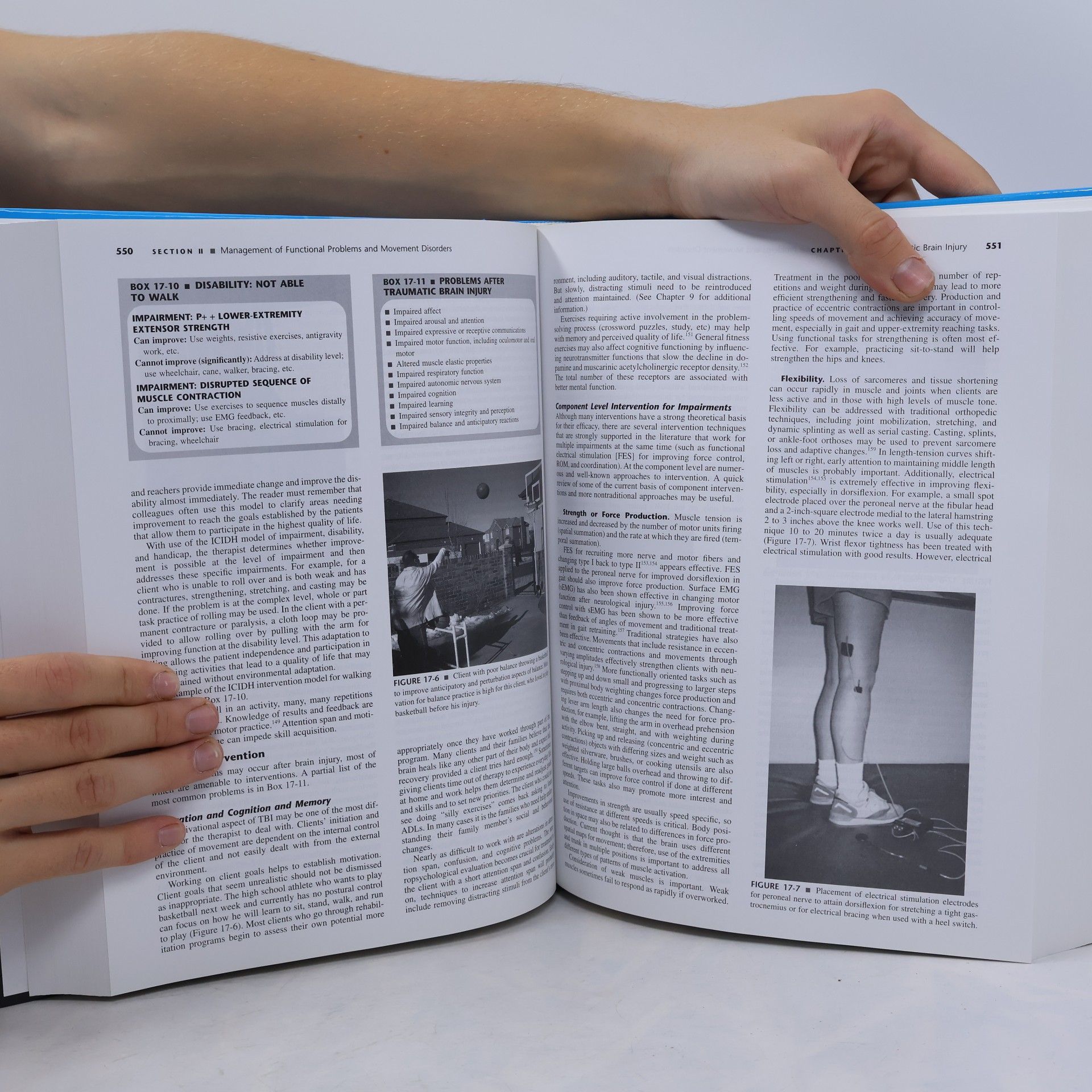 Darcy Ann Umphred Neurological Rehabilitation - Fifth Edition