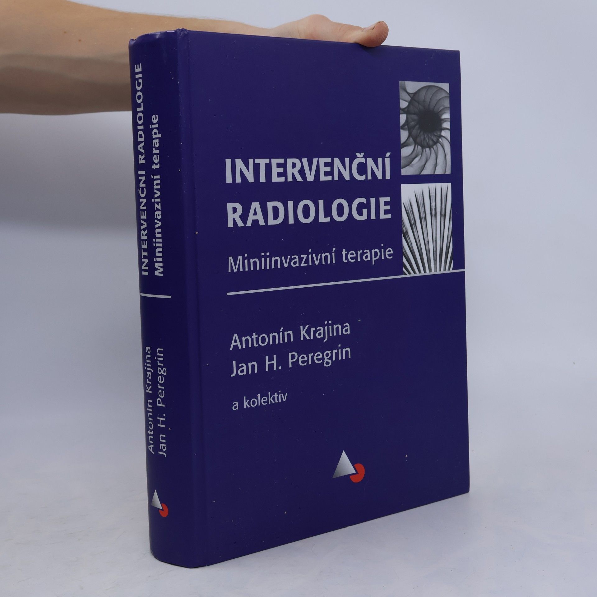 Intervenční radiologie : miniinvazivní terapie