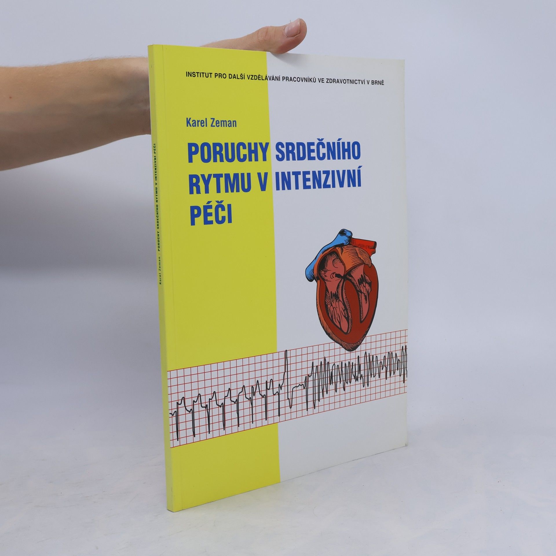 Poruchy srdečního rytmu v intenzivní péči