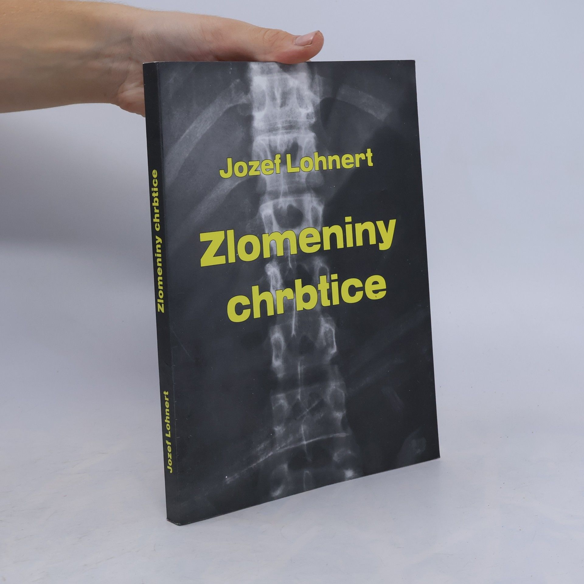 Zlomeniny chrbtice