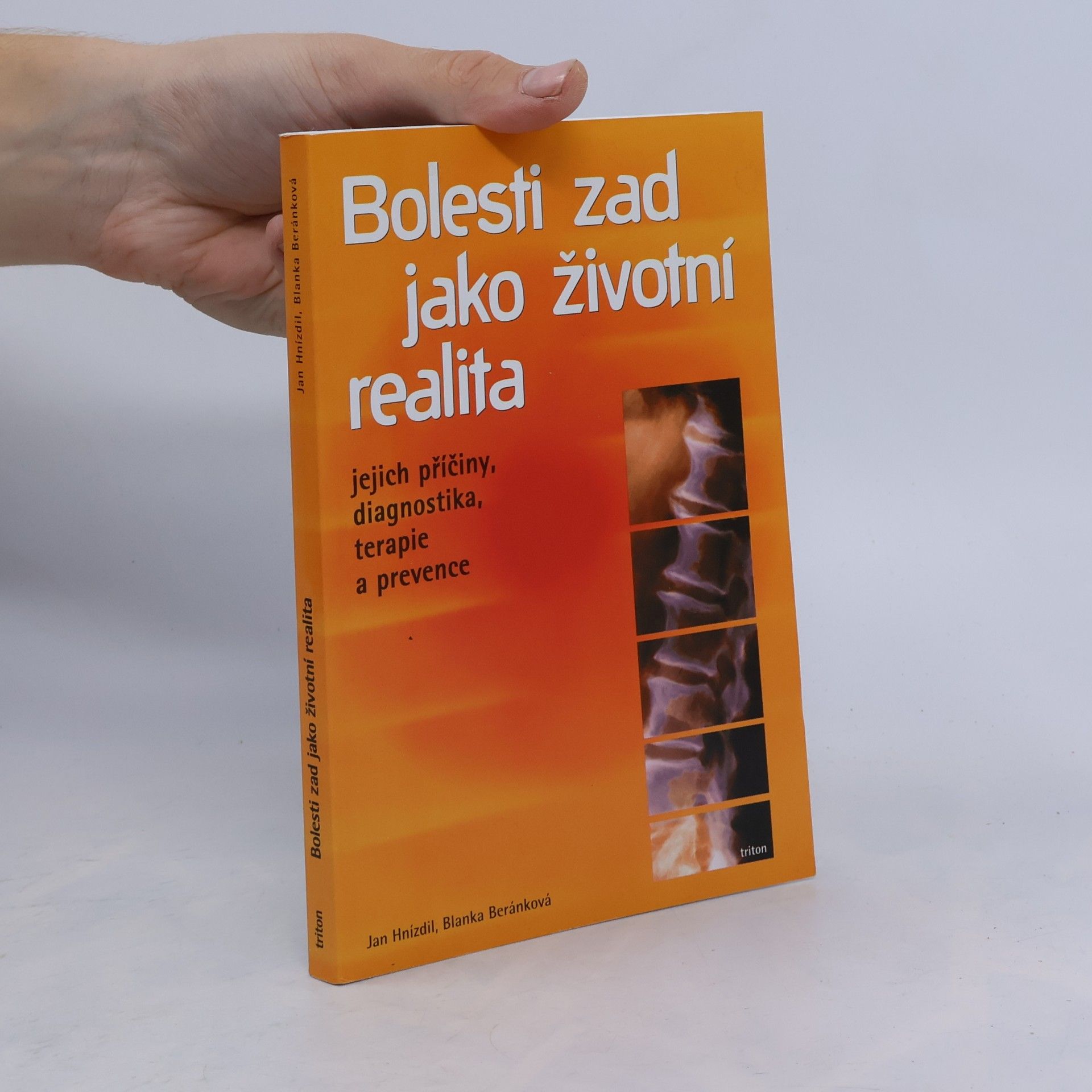 Jan Hnízdil Bolesti zad jako životní realita. Jejich příčiny, diagnostika, terapie a prevence
