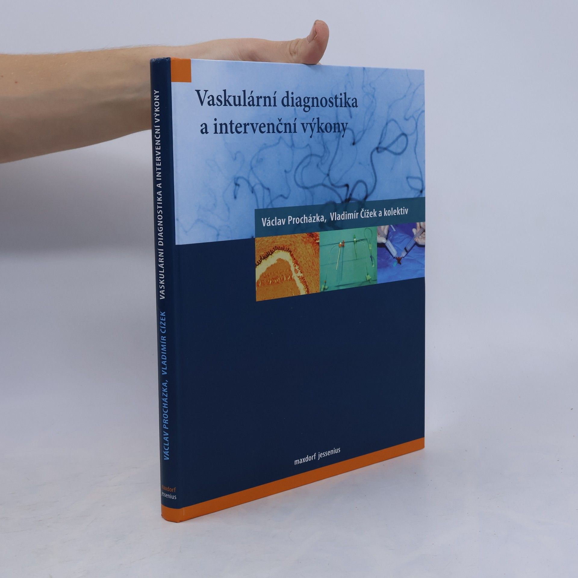 Vladimír Čížek Vaskulární diagnostika a intervenční výkony