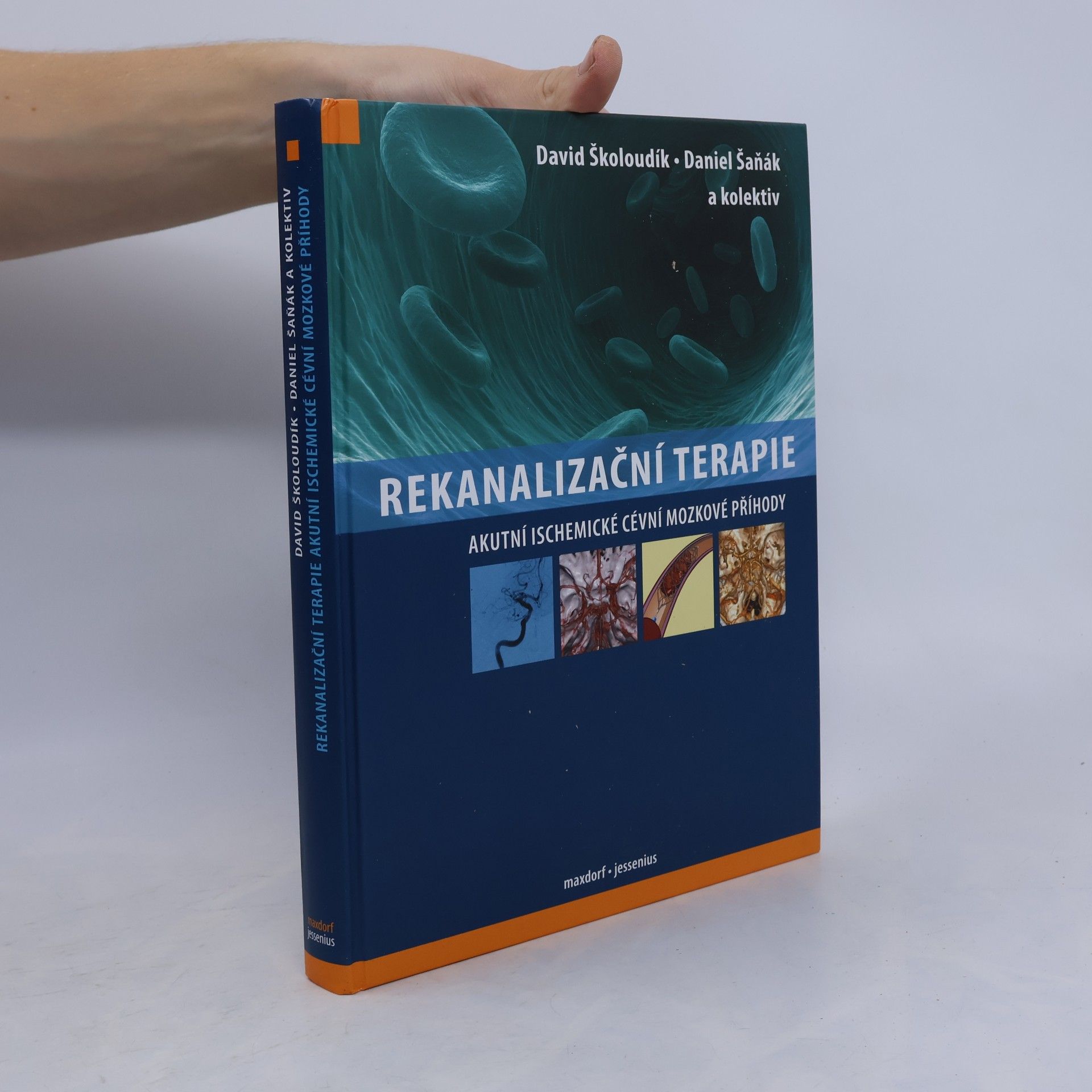 David Školoudík Rekanalizační terapie