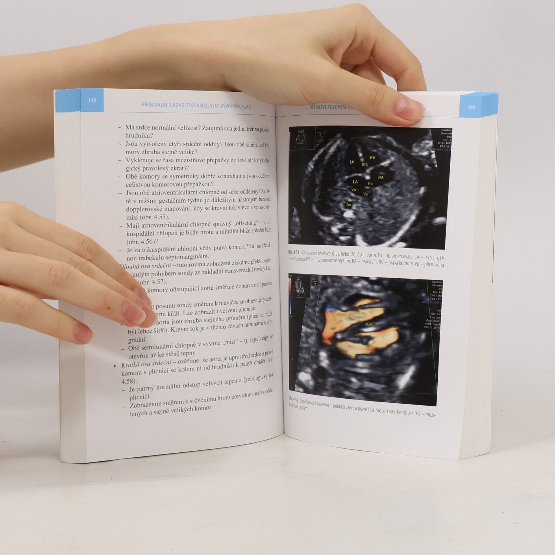 Petr Polák Prenatální diagnostika vrozených vývojových vad