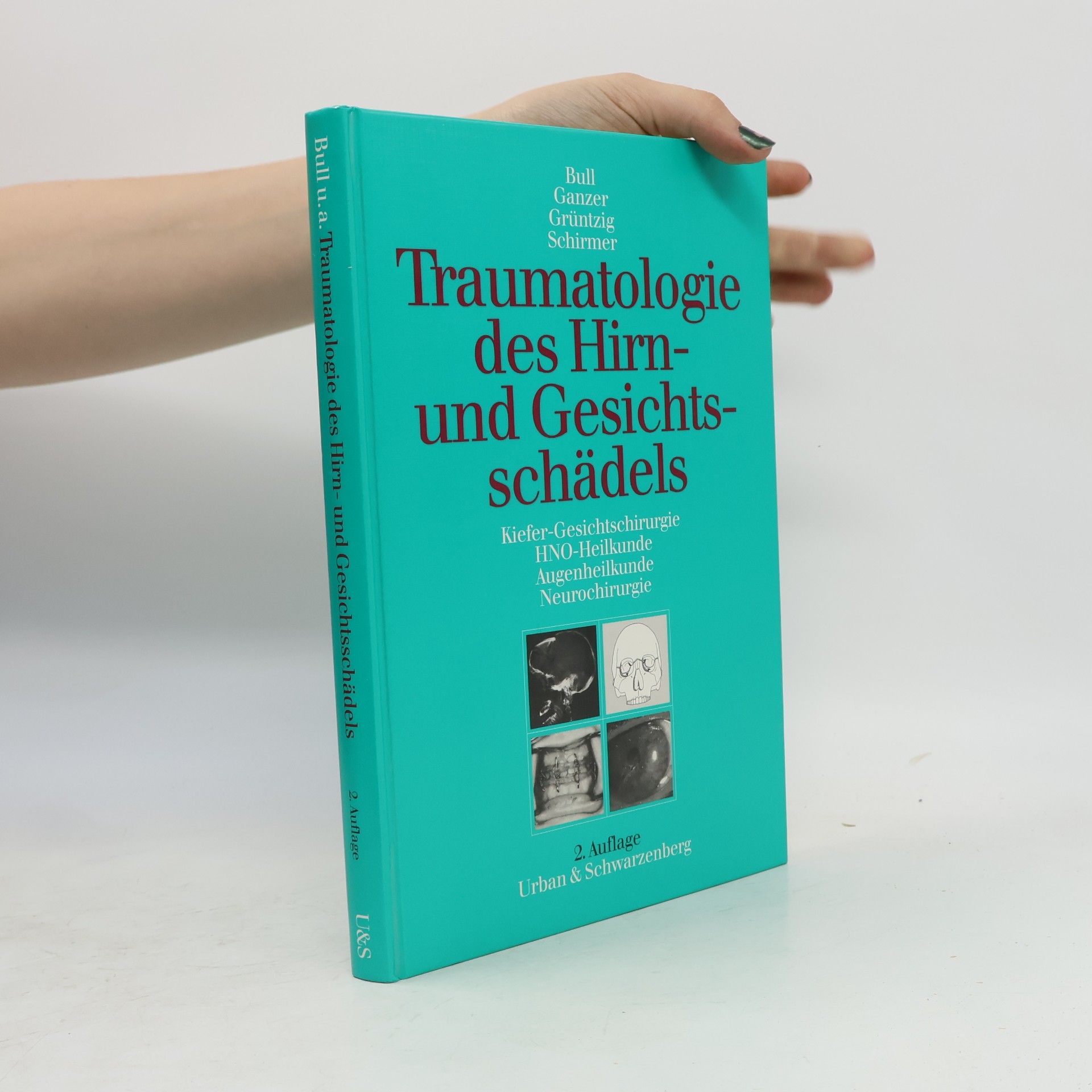 Grüntzig Traumatologie des Hirn- und Gesichtsschädels - 2. Auflage