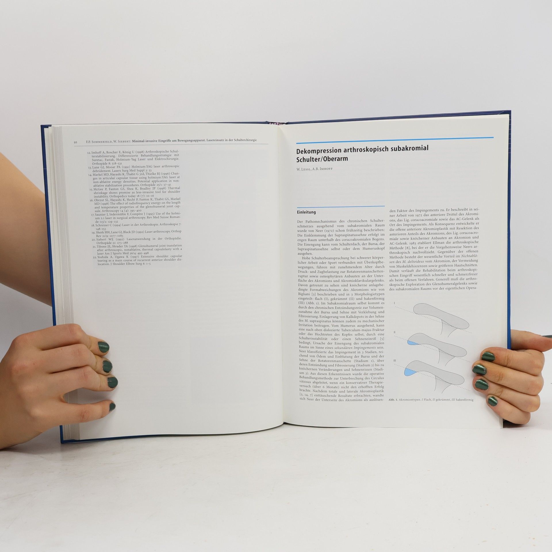 Joachim Pfeil Minimal-invasive Verfahren in der Orthopädie und Traumatologie