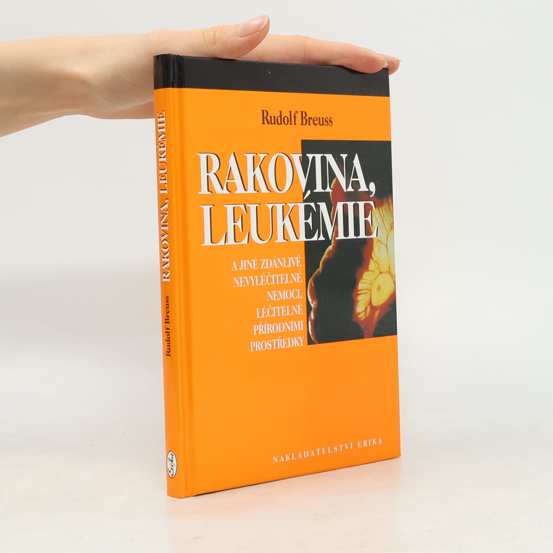 Rudolf Breuss Rakovina, leukémie a jiné zdánlivě nevyléčitelné nemoci, léčitelné přírodními prostředky
