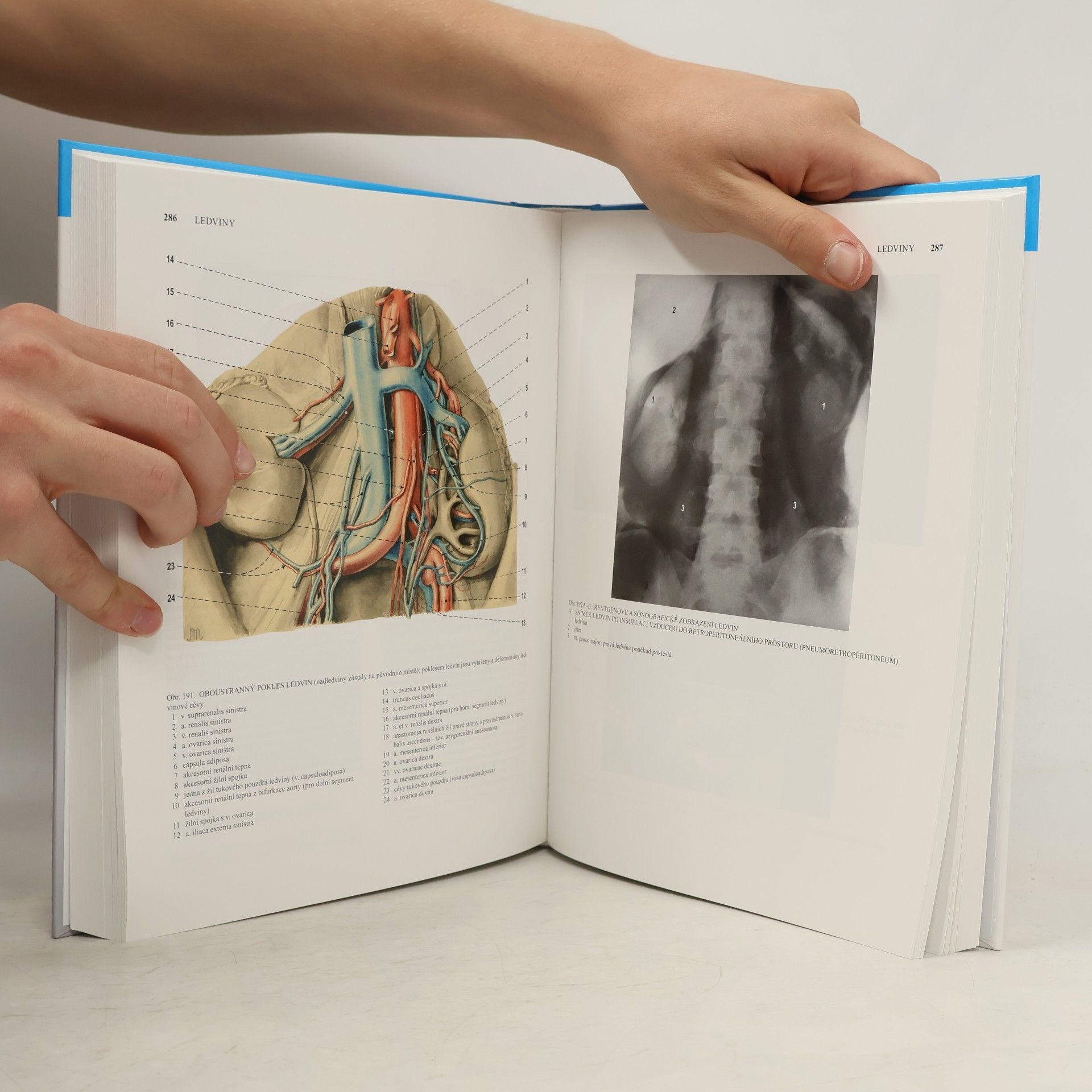 Radomír Čihák Anatomie 2