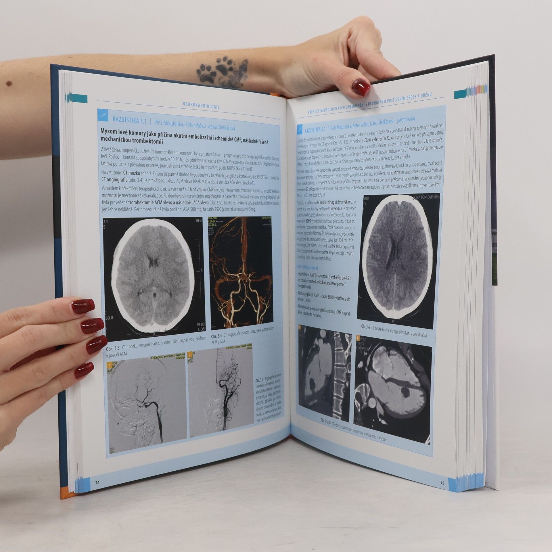 Petr Widimský Neurokardiologie