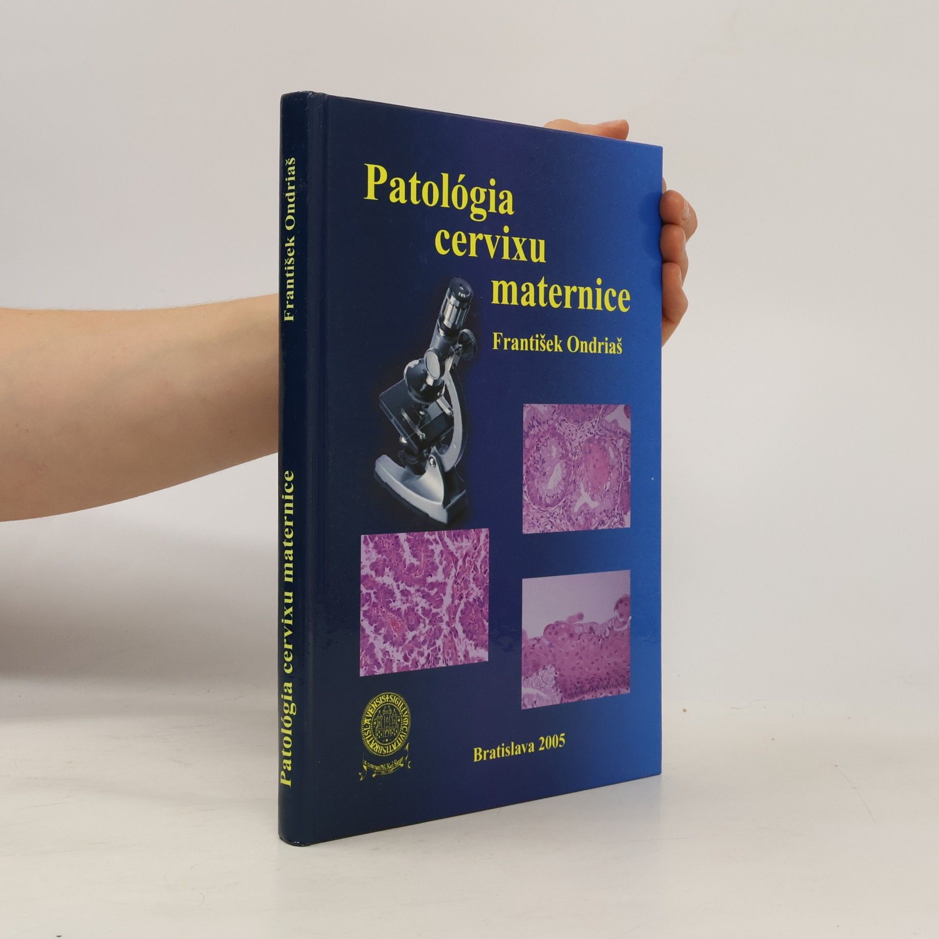 František Ondriaš Patológia cervixu maternice