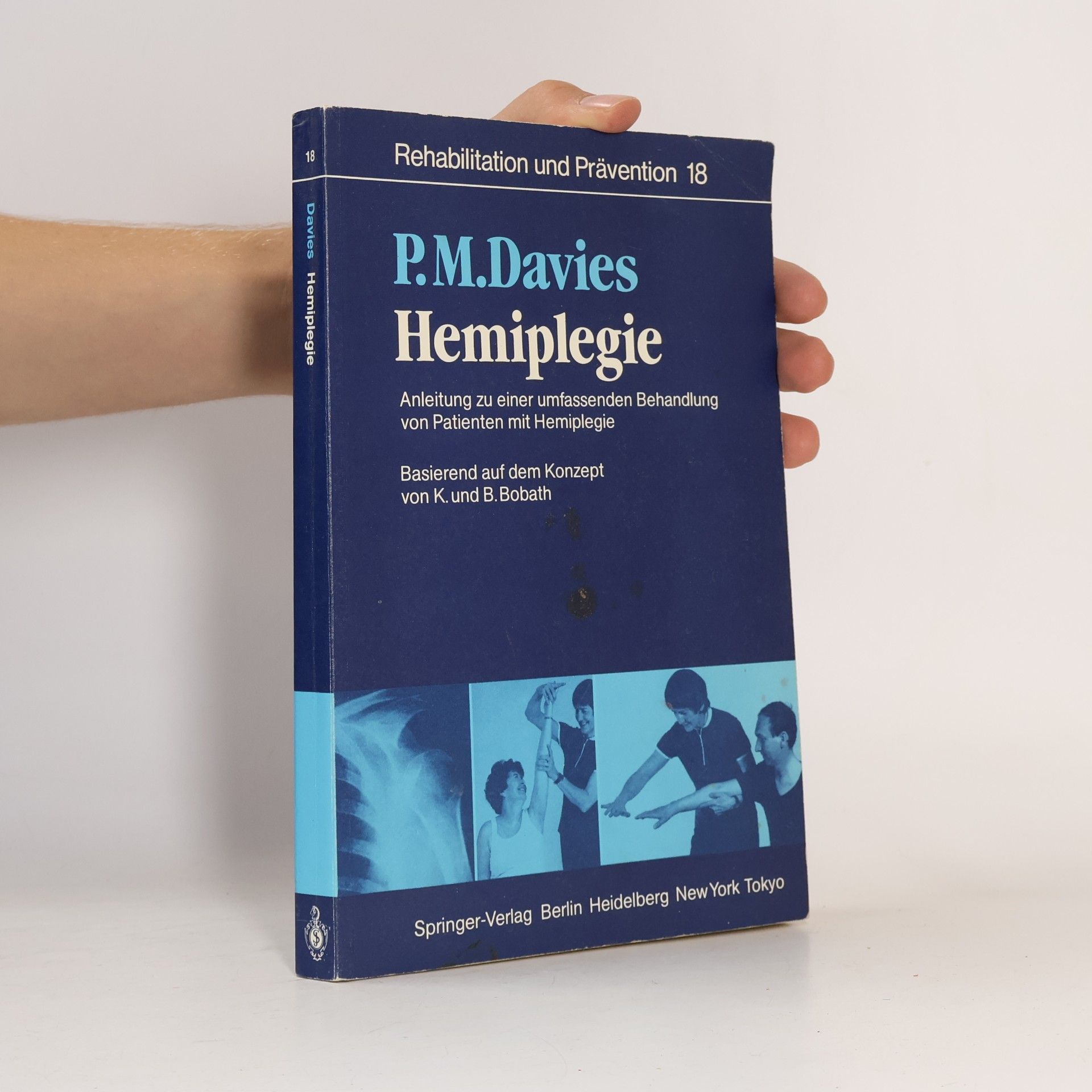 Patricia M. Davies Hemiplegie