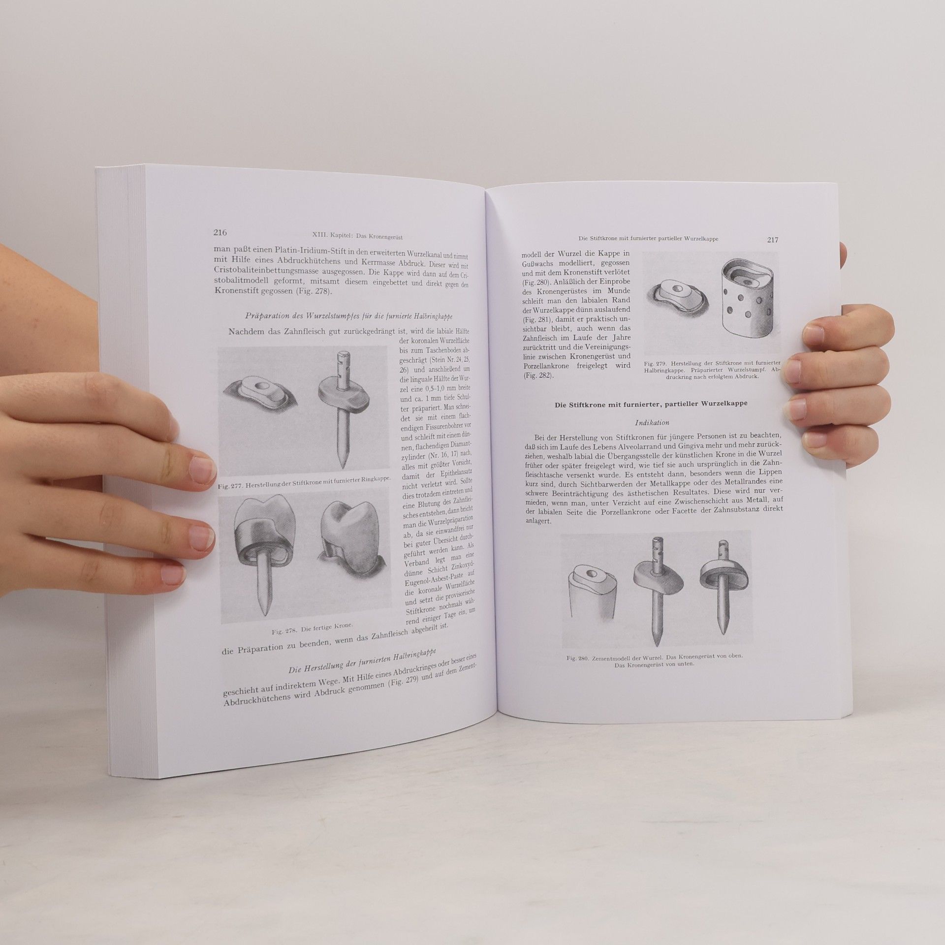 G. Vest Lehrbuch der Zahnärztlichen Kronen- und Brückenprothetik