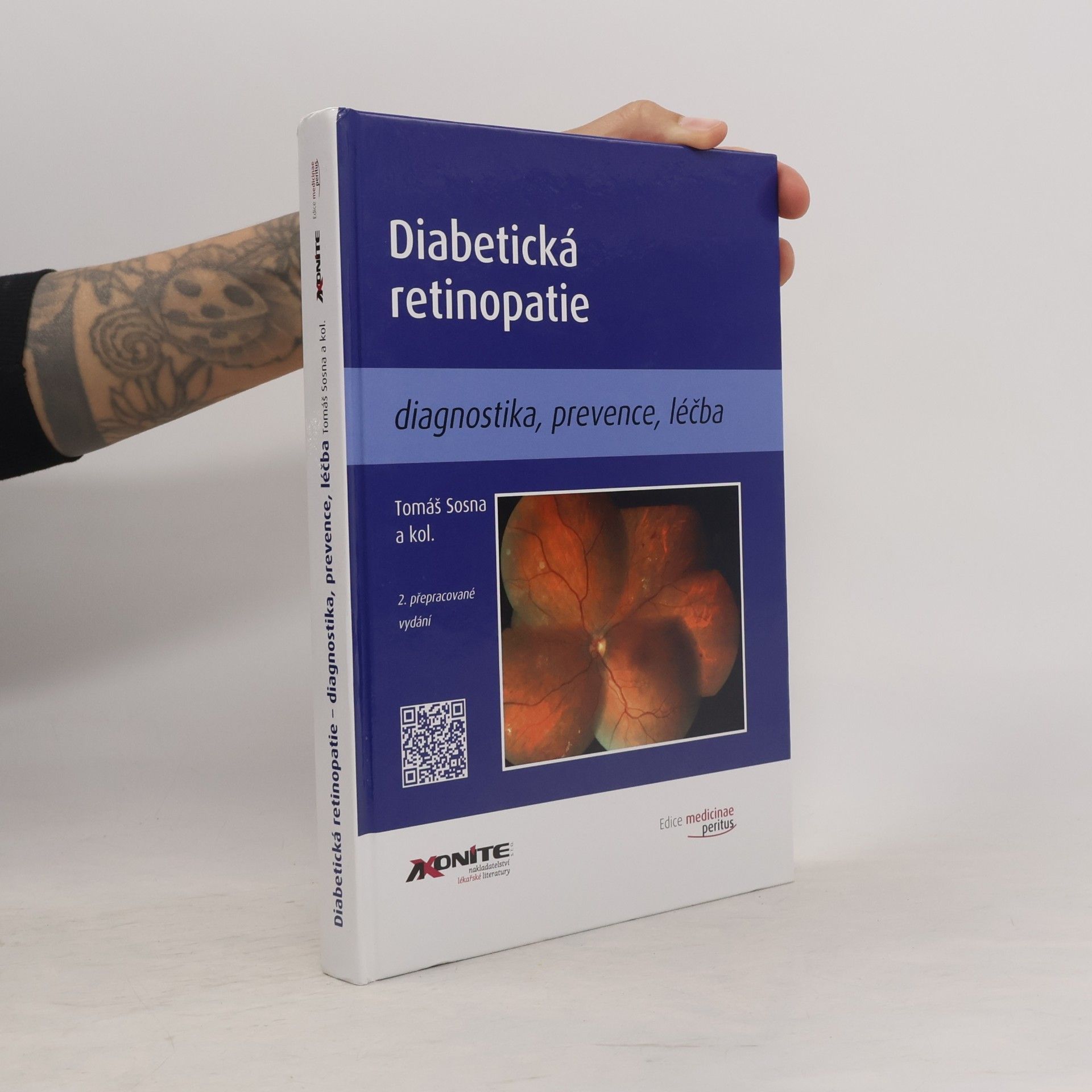 Tomáš Sosna Diabetická retinopatie
