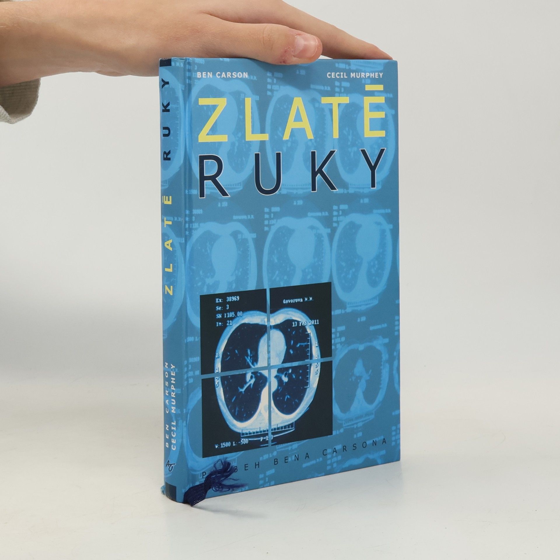Carson Murphey Zlaté ruky