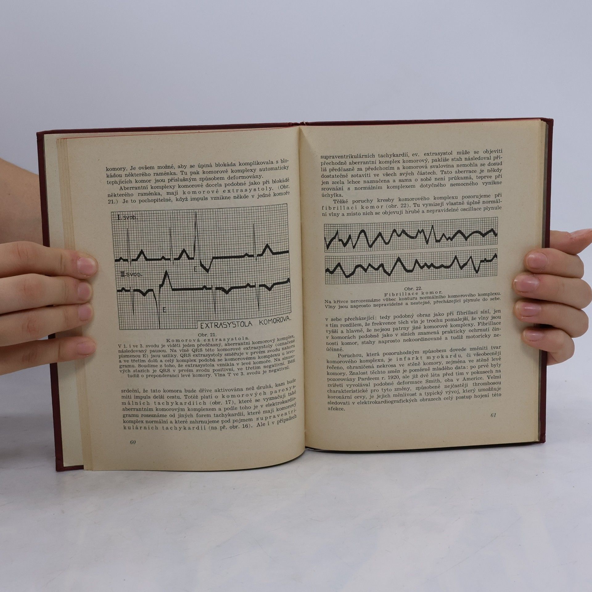 Josef Pelnář Elektrokardiografie v praxi III