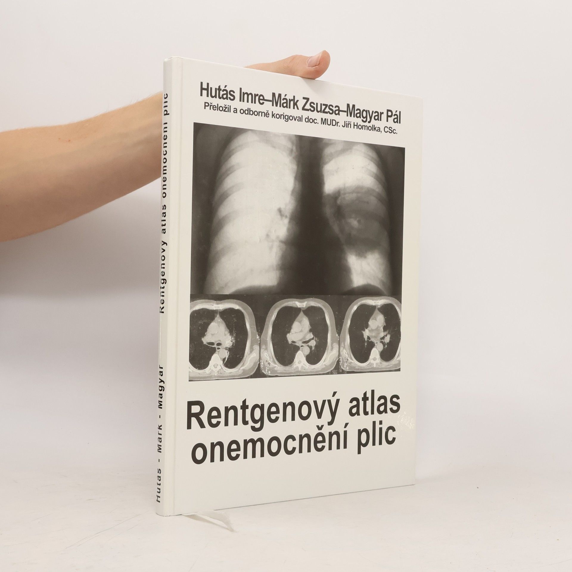 Rentgenový atlas onemocnění plic