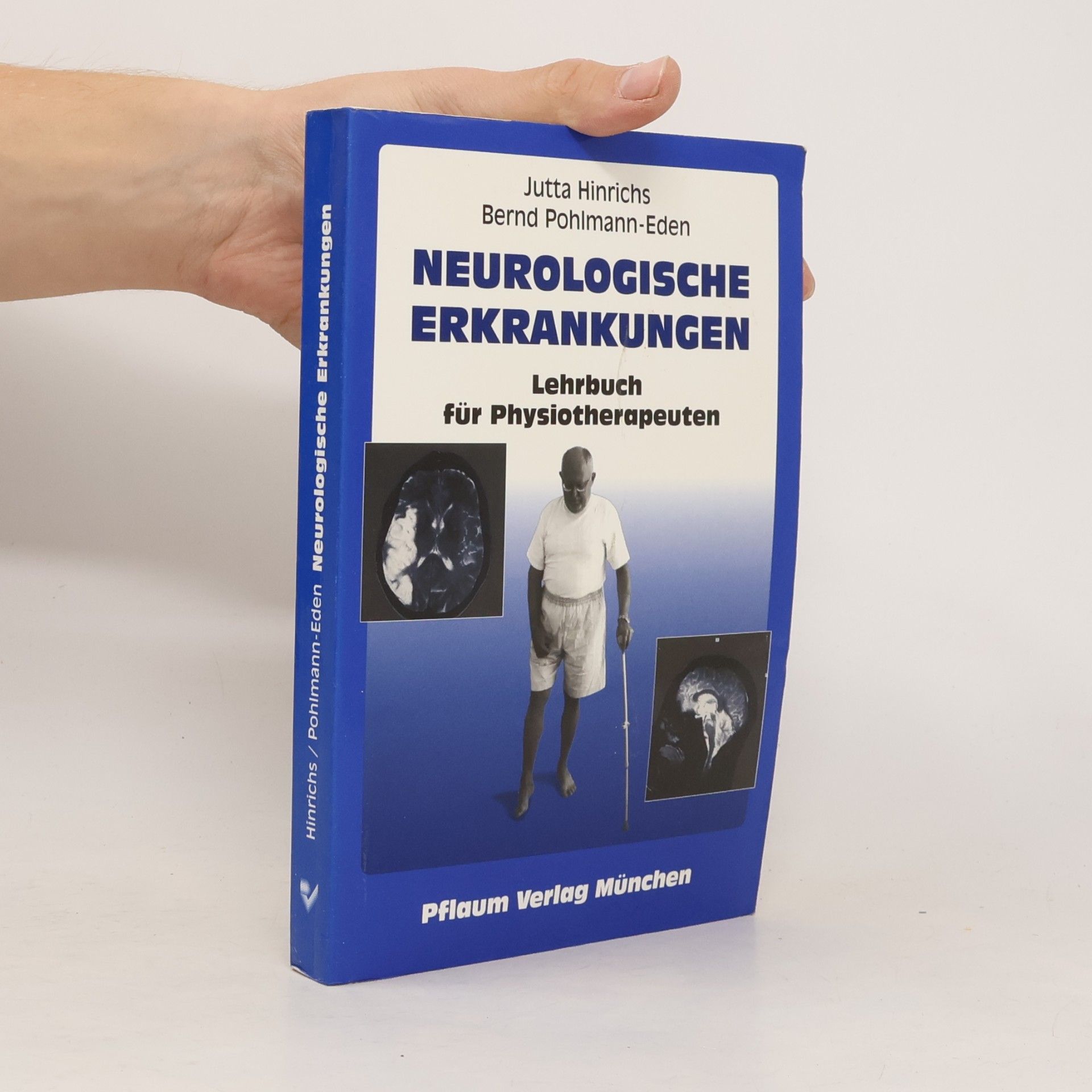 Neurologische Erkrankungen