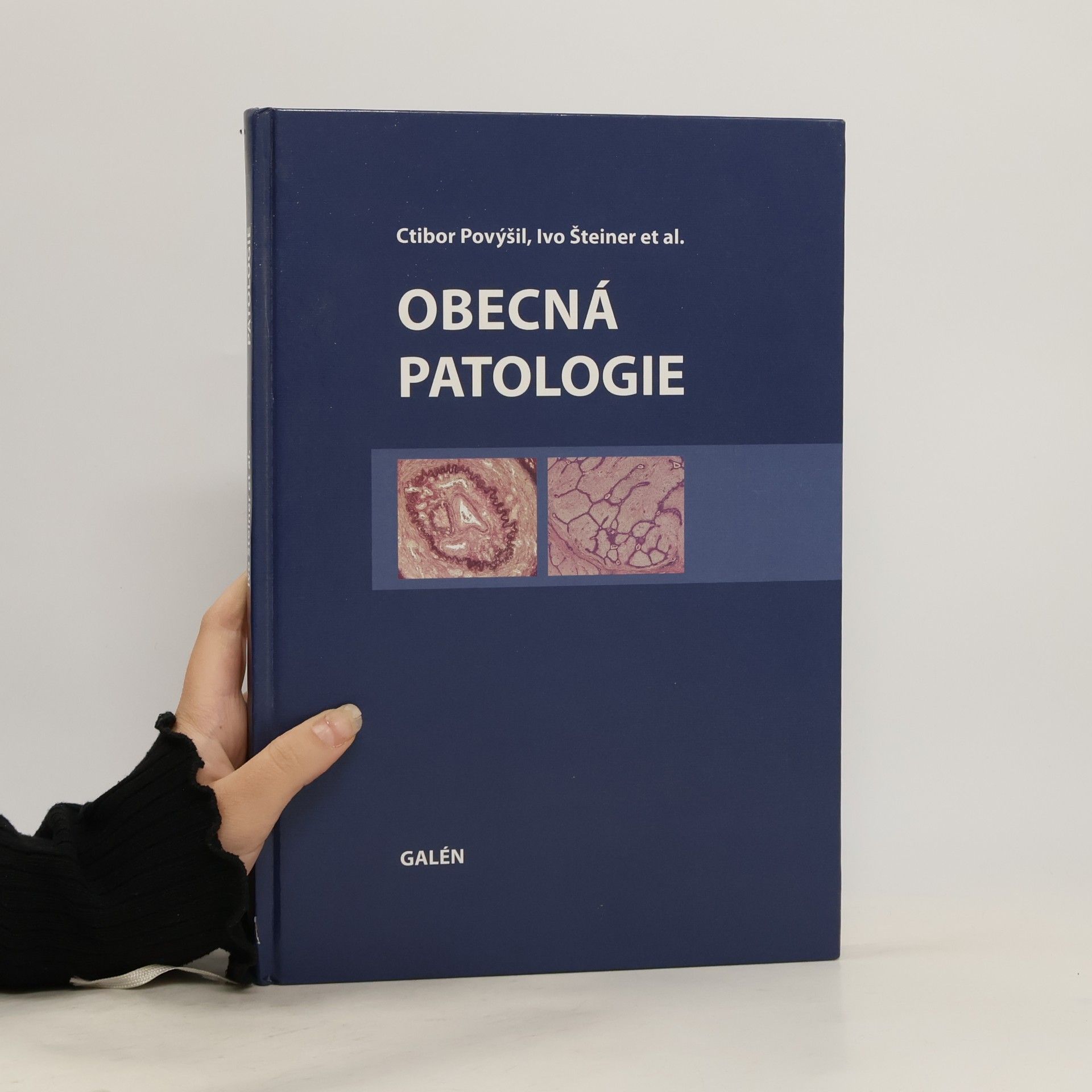 Ivo Šteiner Obecná patologie