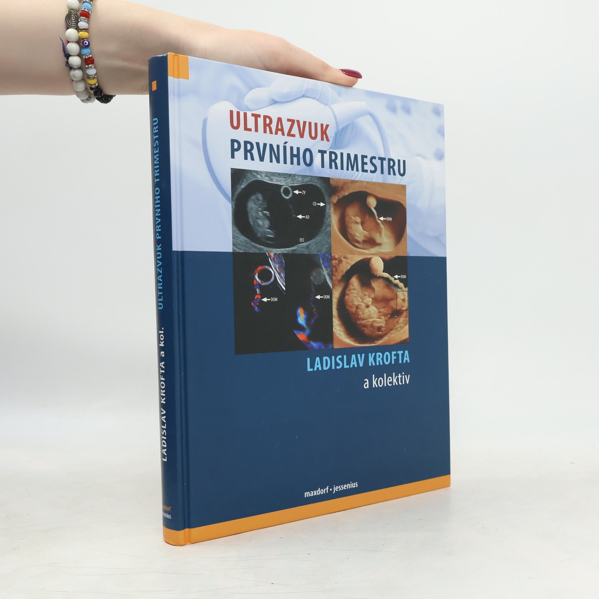 Ladislav Krofta Ultrazvuk prvního trimestru