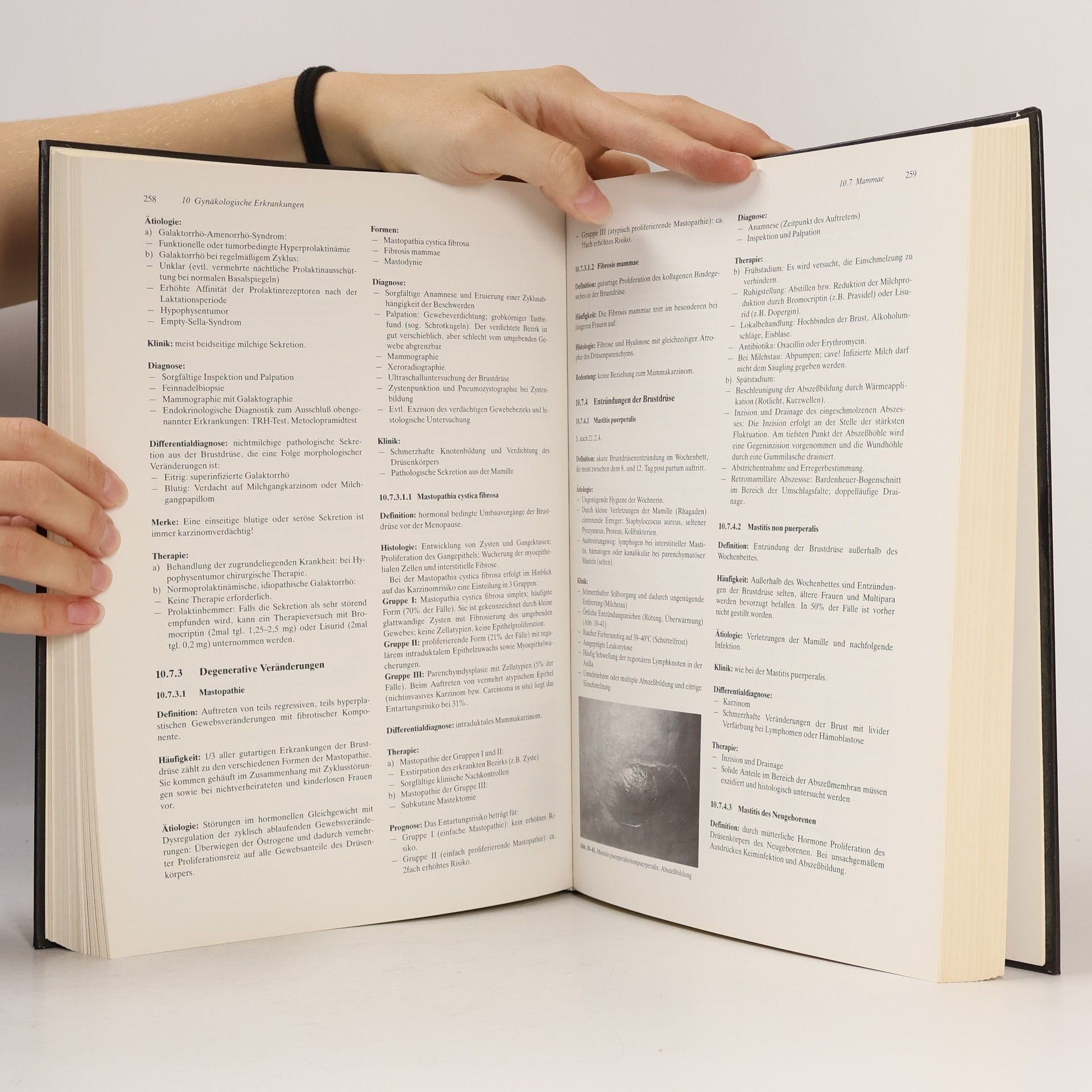 Thomas Rabe Gynäkologie und Geburtshilfe Lehrbuch