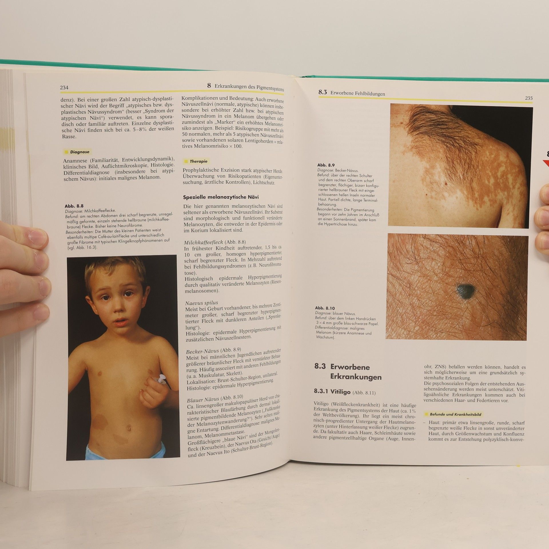 Gernot Rassner Dermatologie