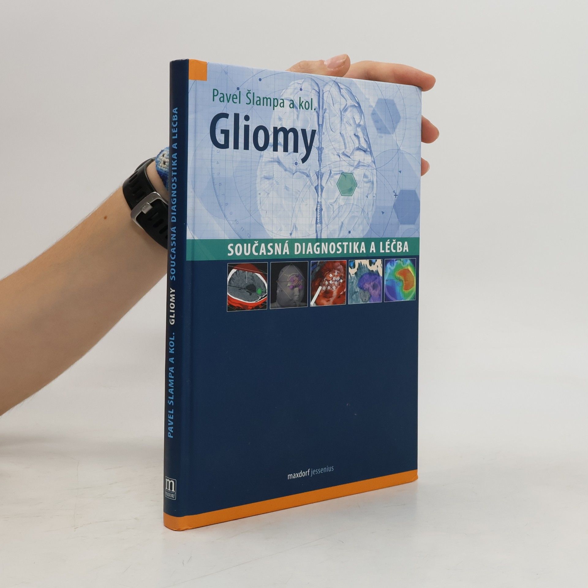 kolektiv autorů Gliomy