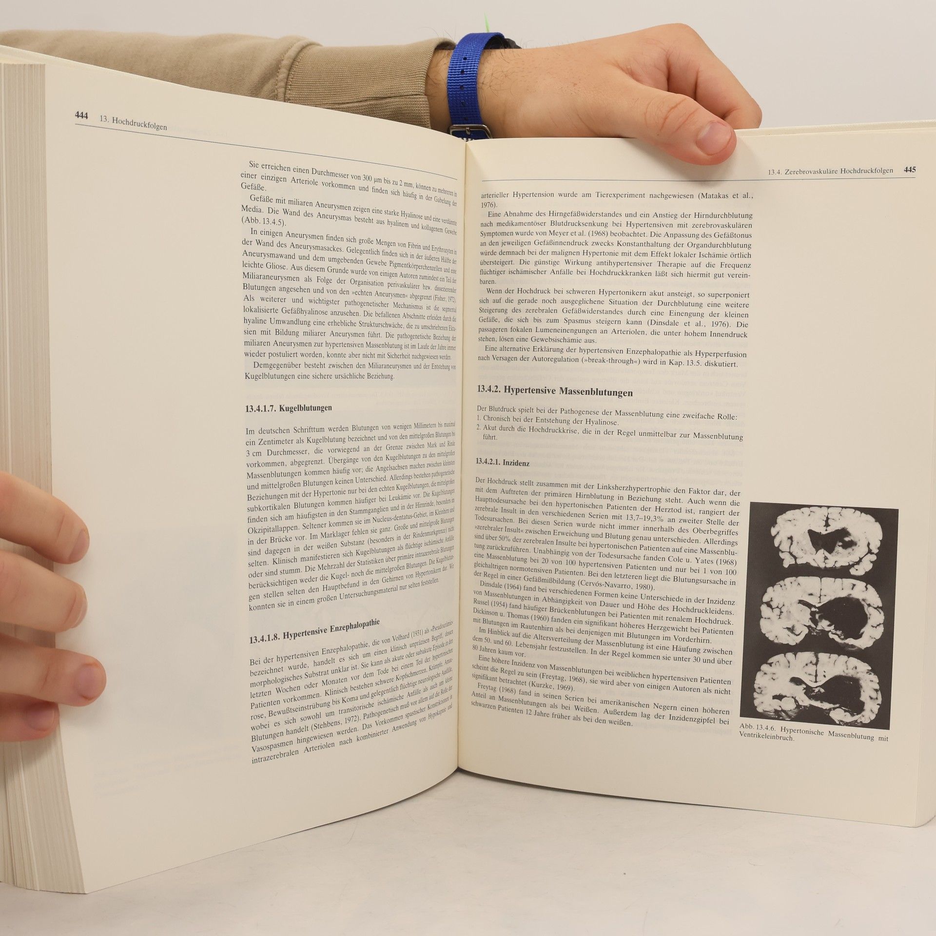 Detlev Ganten Lehrbuch der Hypertonie