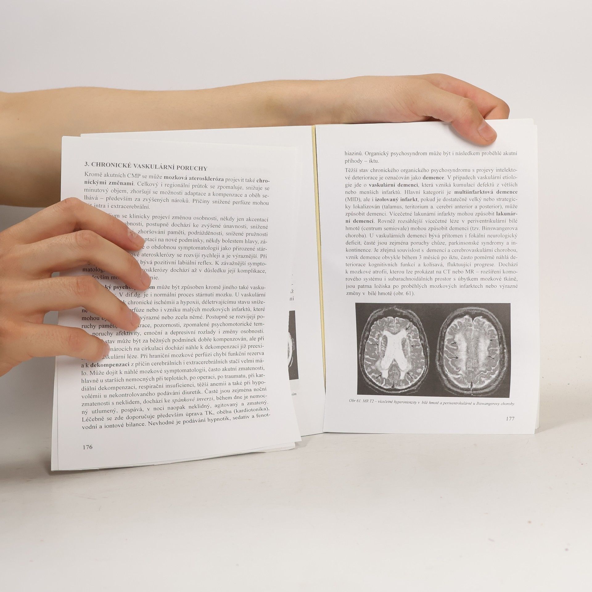Zdeněk Ambler Neurologie pro studenty lékařské fakulty