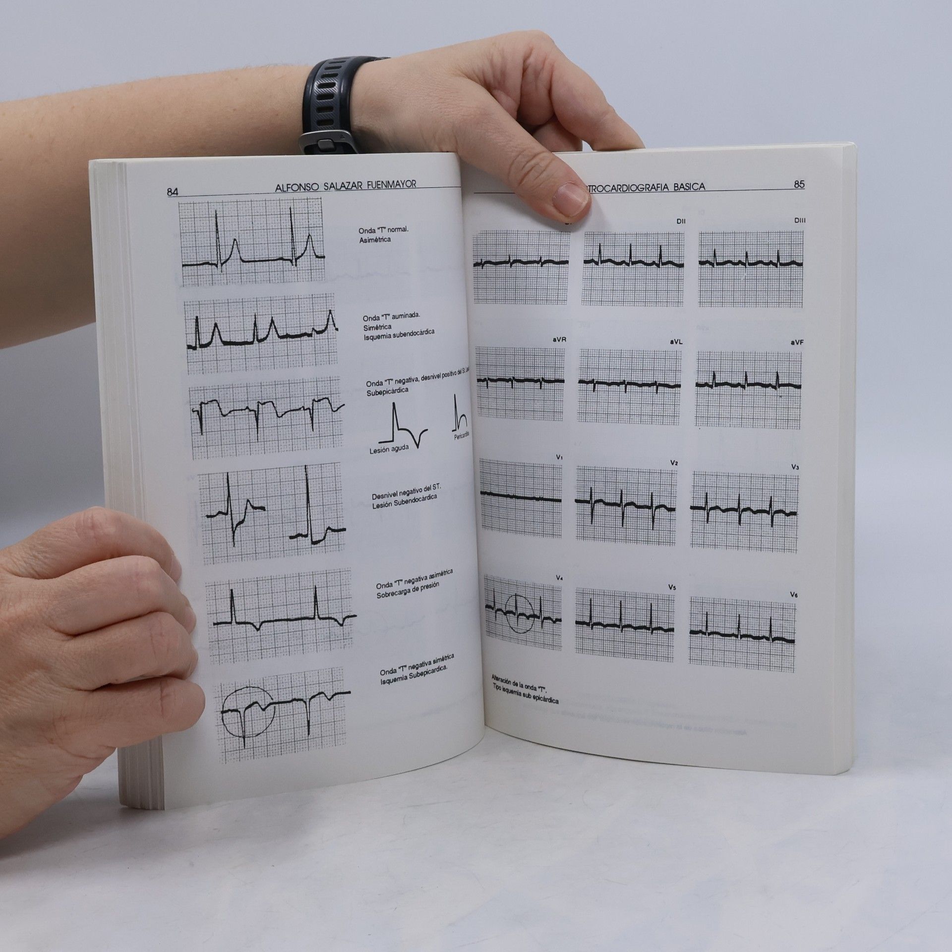 Alfonso Salazar Fuenmayor Electrocardiografía básica