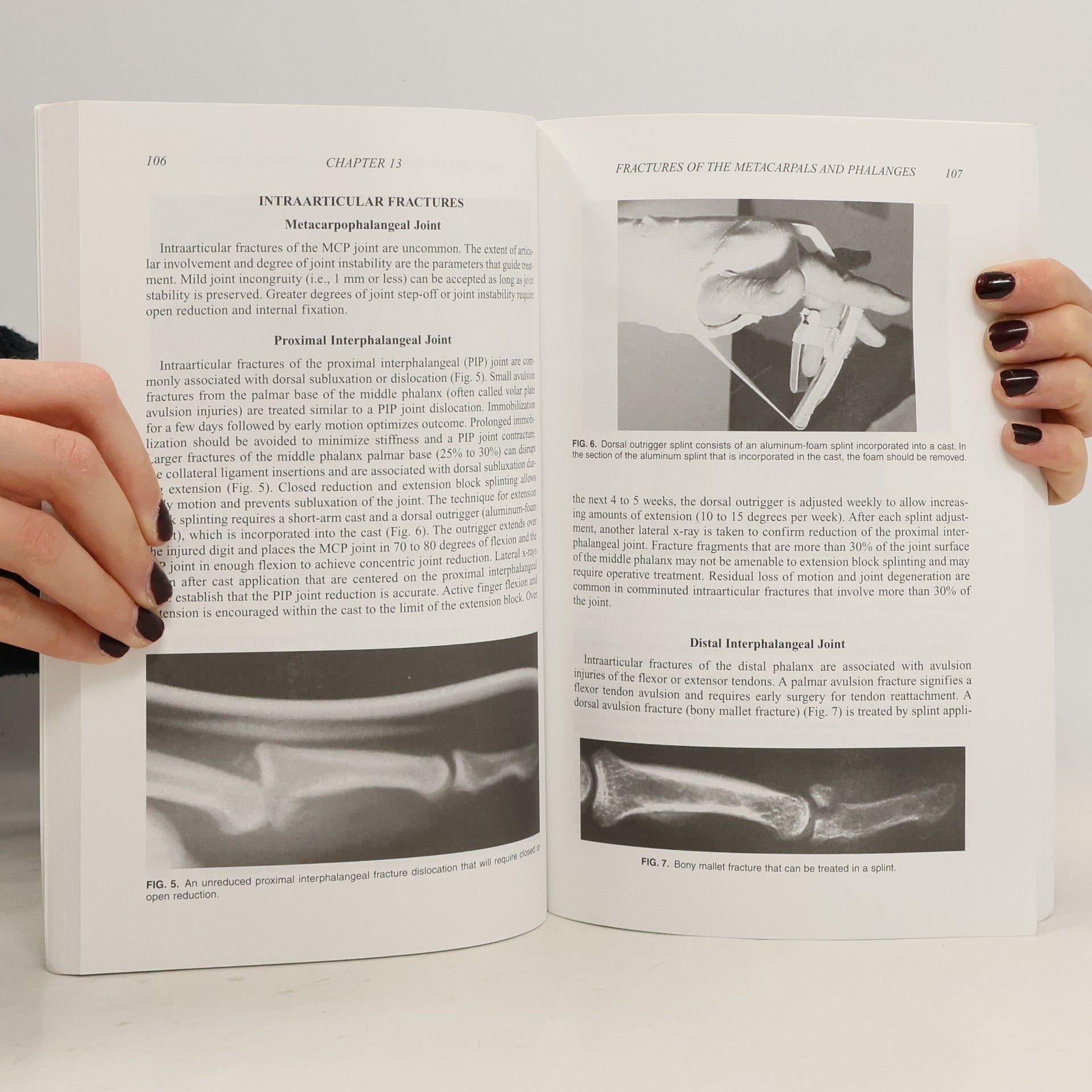 John Gray Seiler III MD Essentials of Hand Surgery