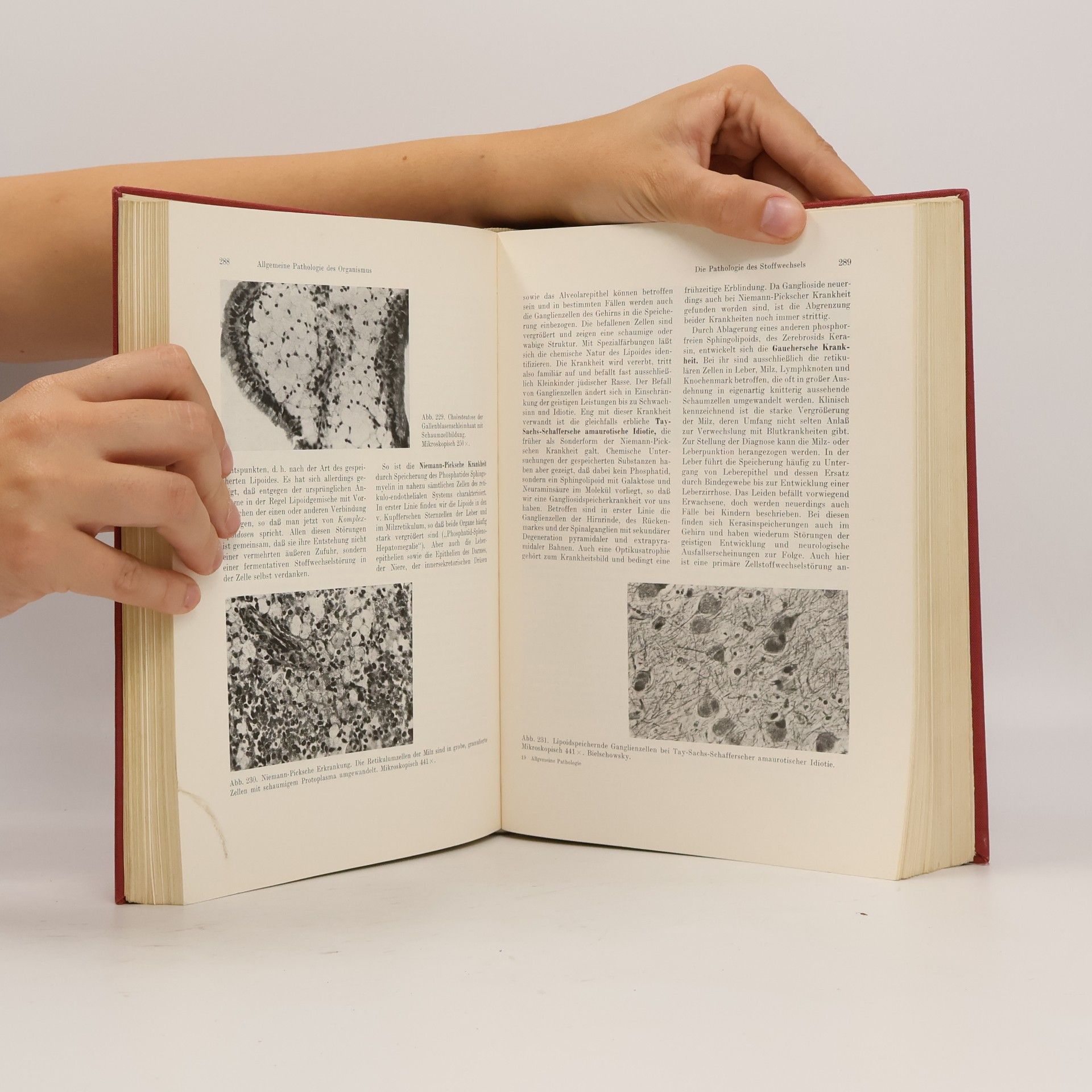Gottfried Holle LEHRBUCH DER ALLGEMEINEN PATHOLOGIE