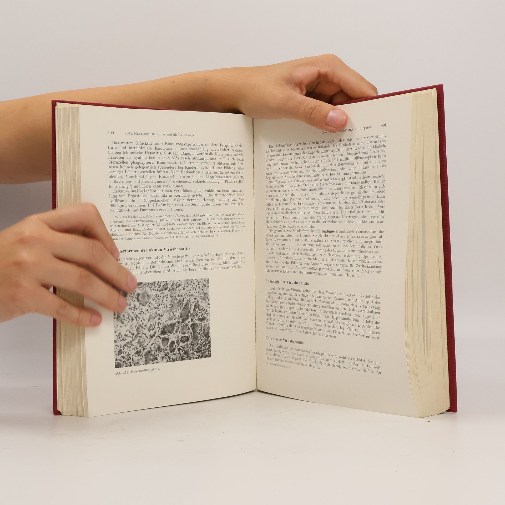 Louis-Heinz Kettler Lehrbuch der speziellen Pathologie