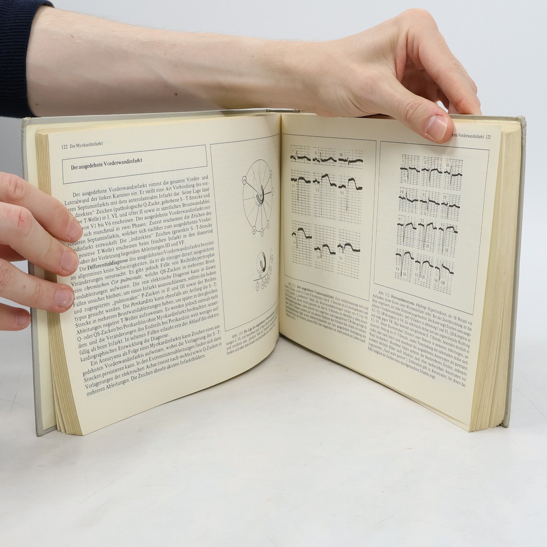 Otto Ritter Atlas der Elektrokardiographie