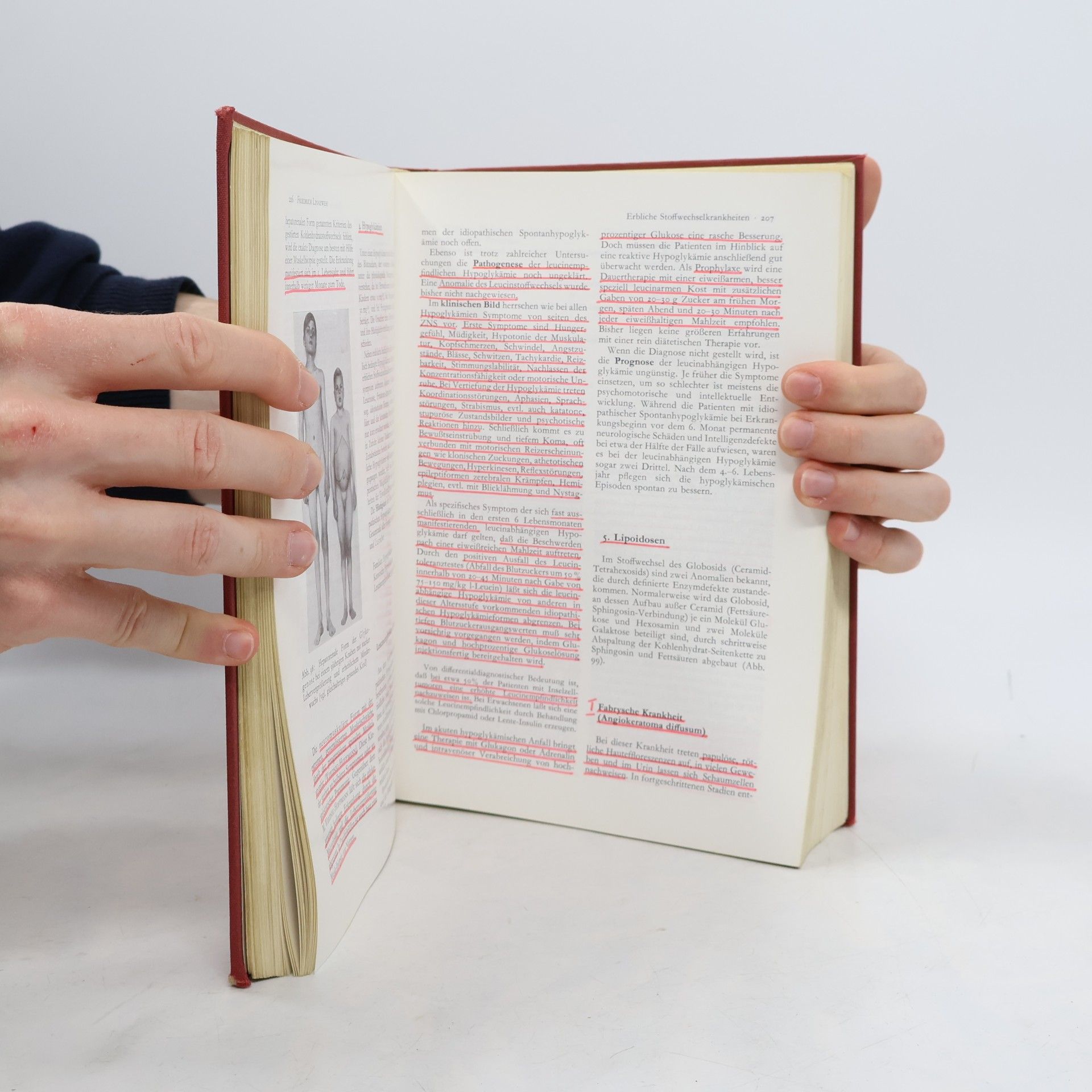 kolektiv Lehrbuch der Kinderheilkunde