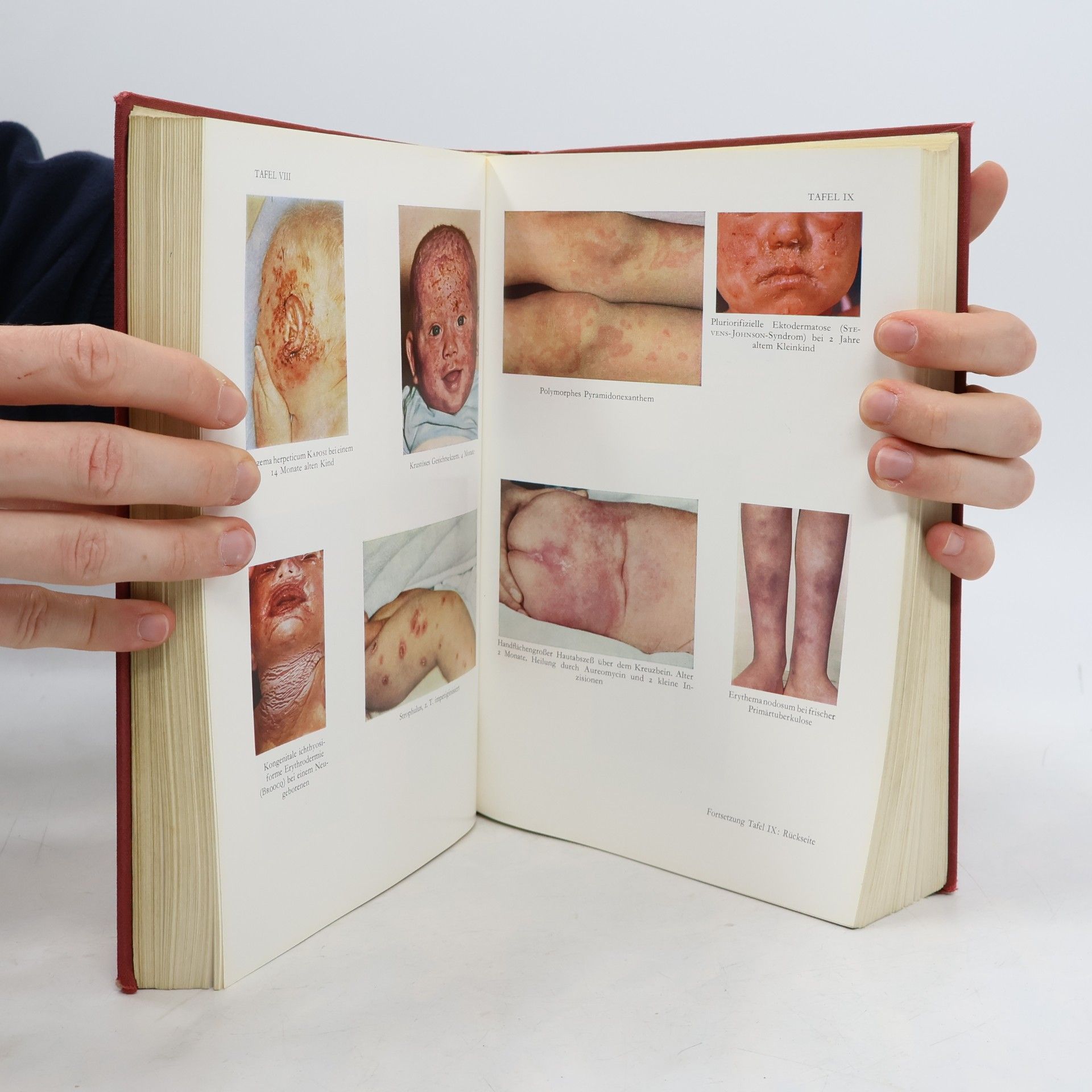 kolektiv Lehrbuch der Kinderheilkunde