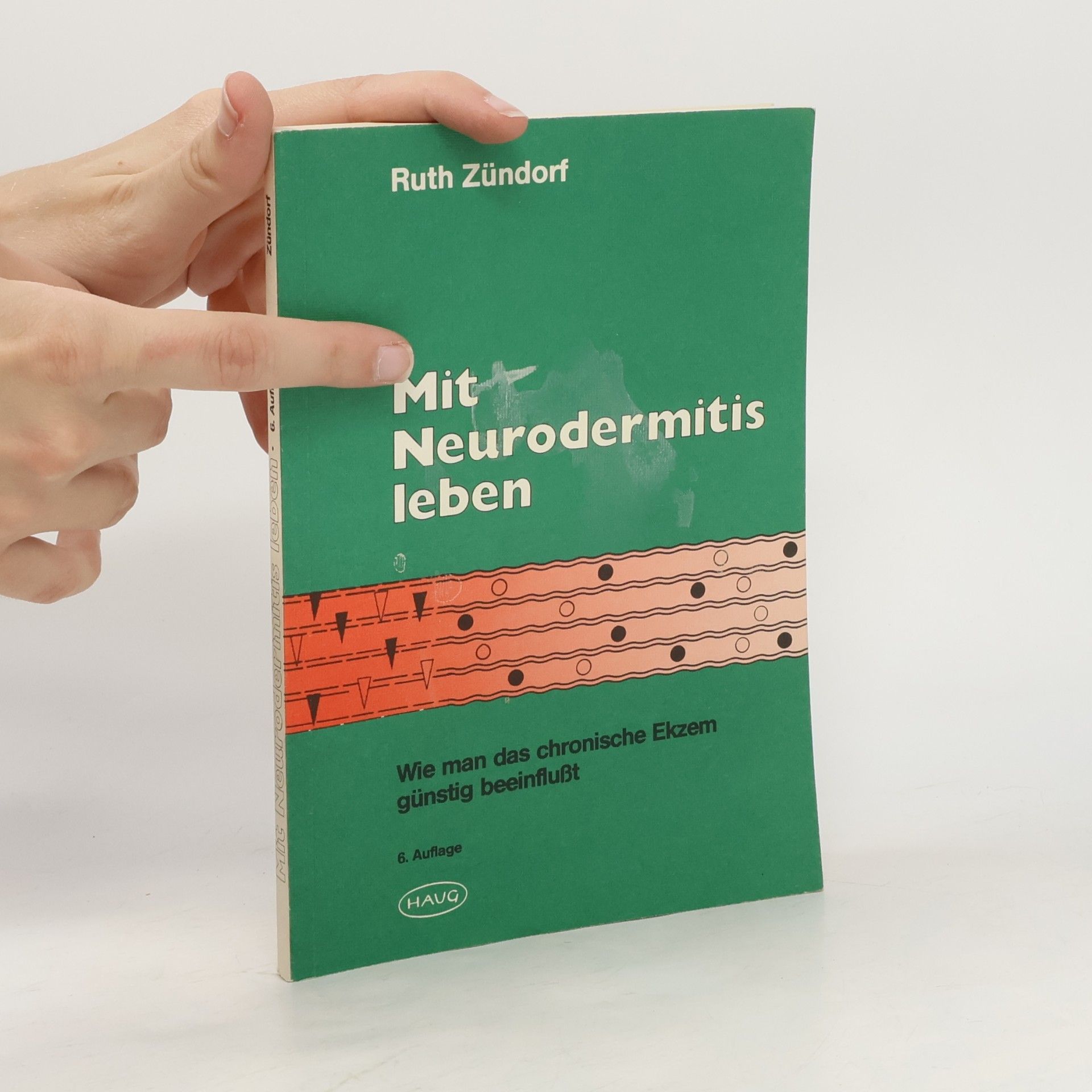 Ruth Zündorf Mit Neurodermitis leben
