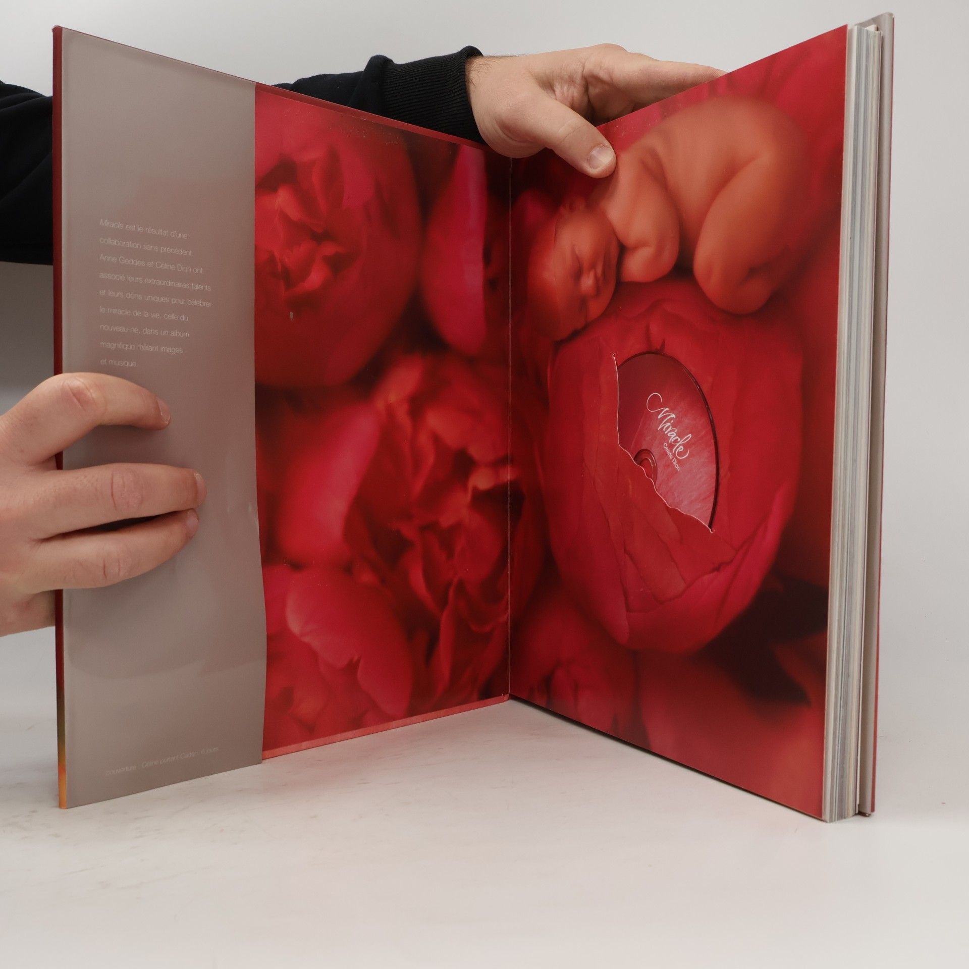 Anne Geddes Miracle