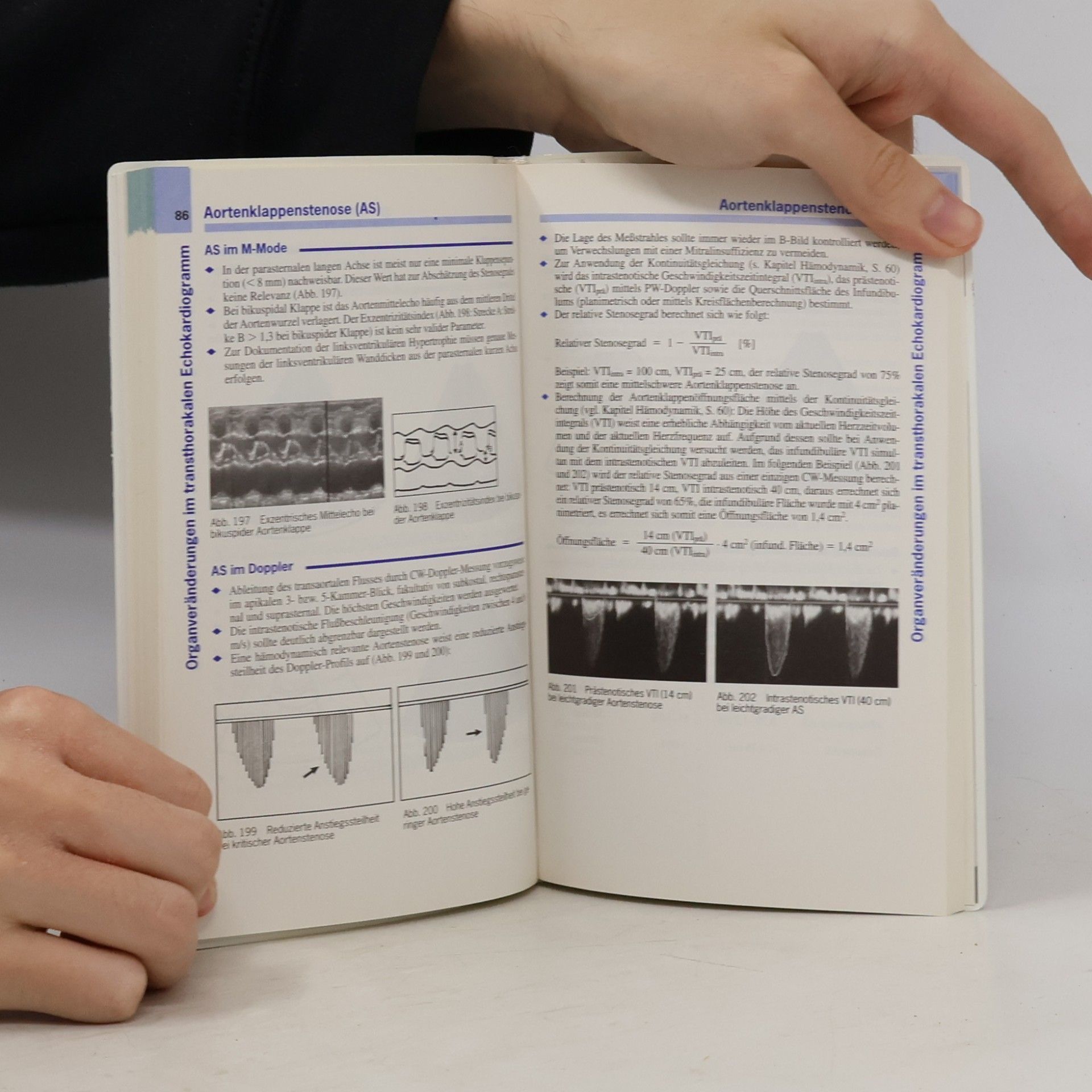 Thomas Böhmeke Checkliste Echokardiographie
