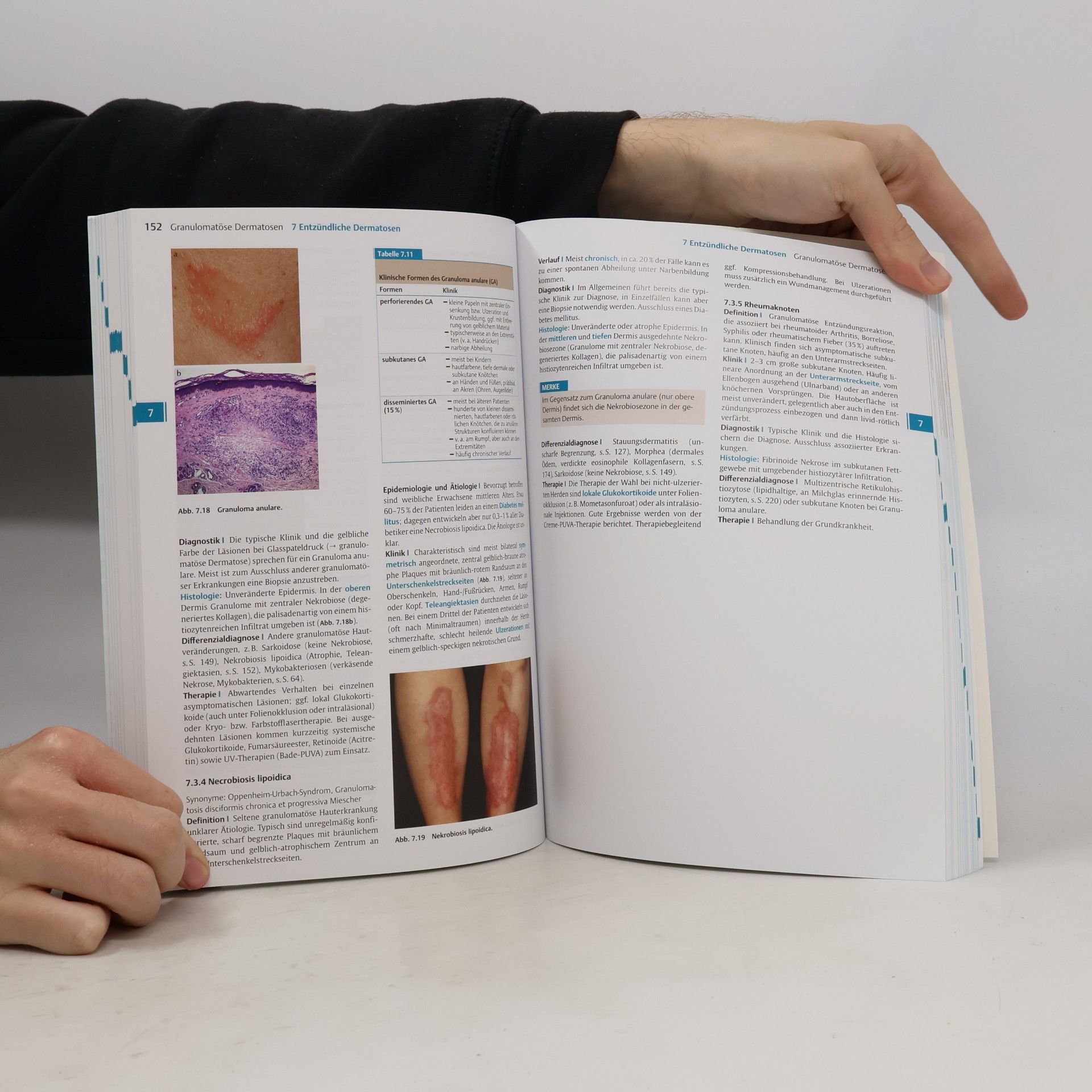 Wolfram Sterry Kurzlehrbuch Dermatologie