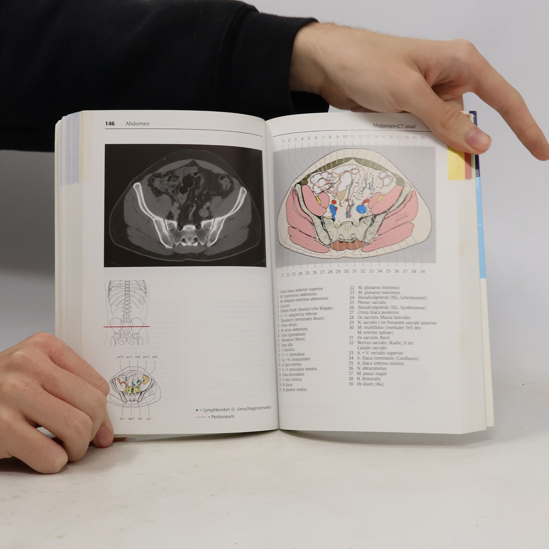 Torsten B. Möller Taschenatlas der Schnittbildanatomie