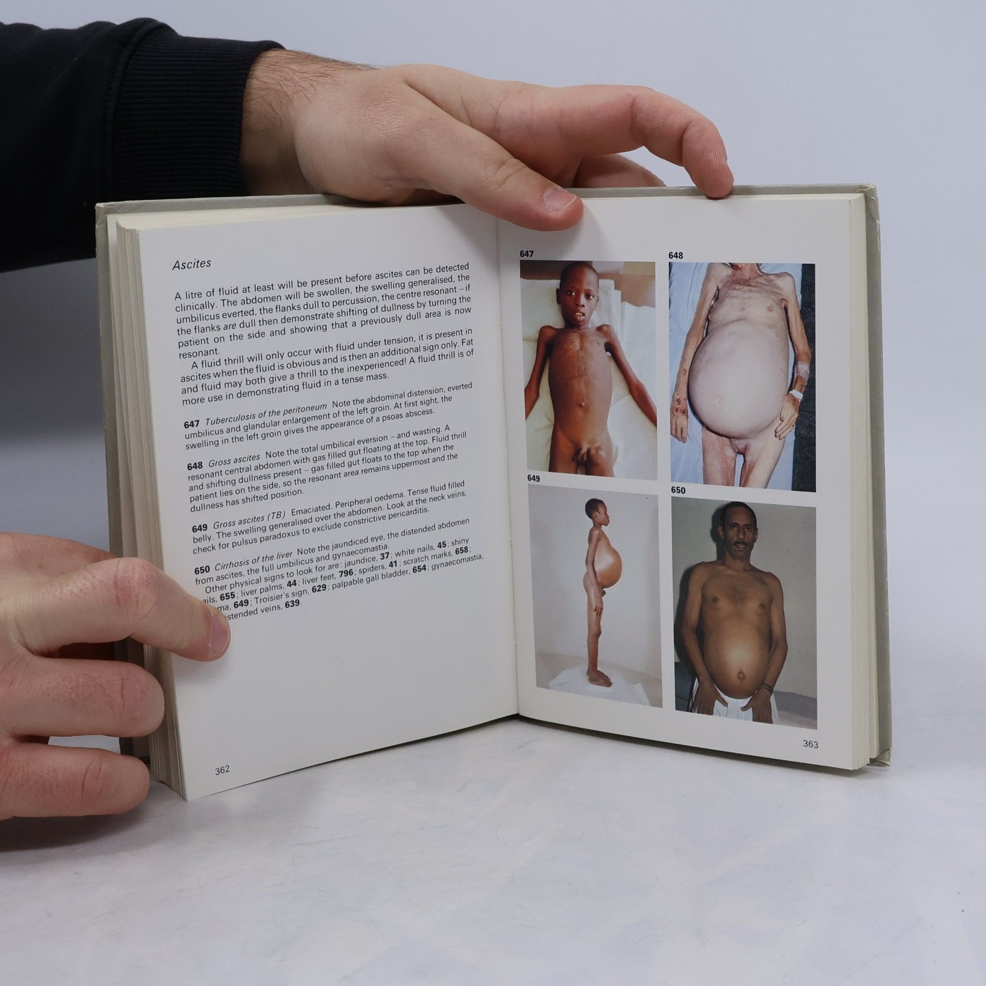 M. Zatouroff A colour atlas of Physical Signs in General Medicine