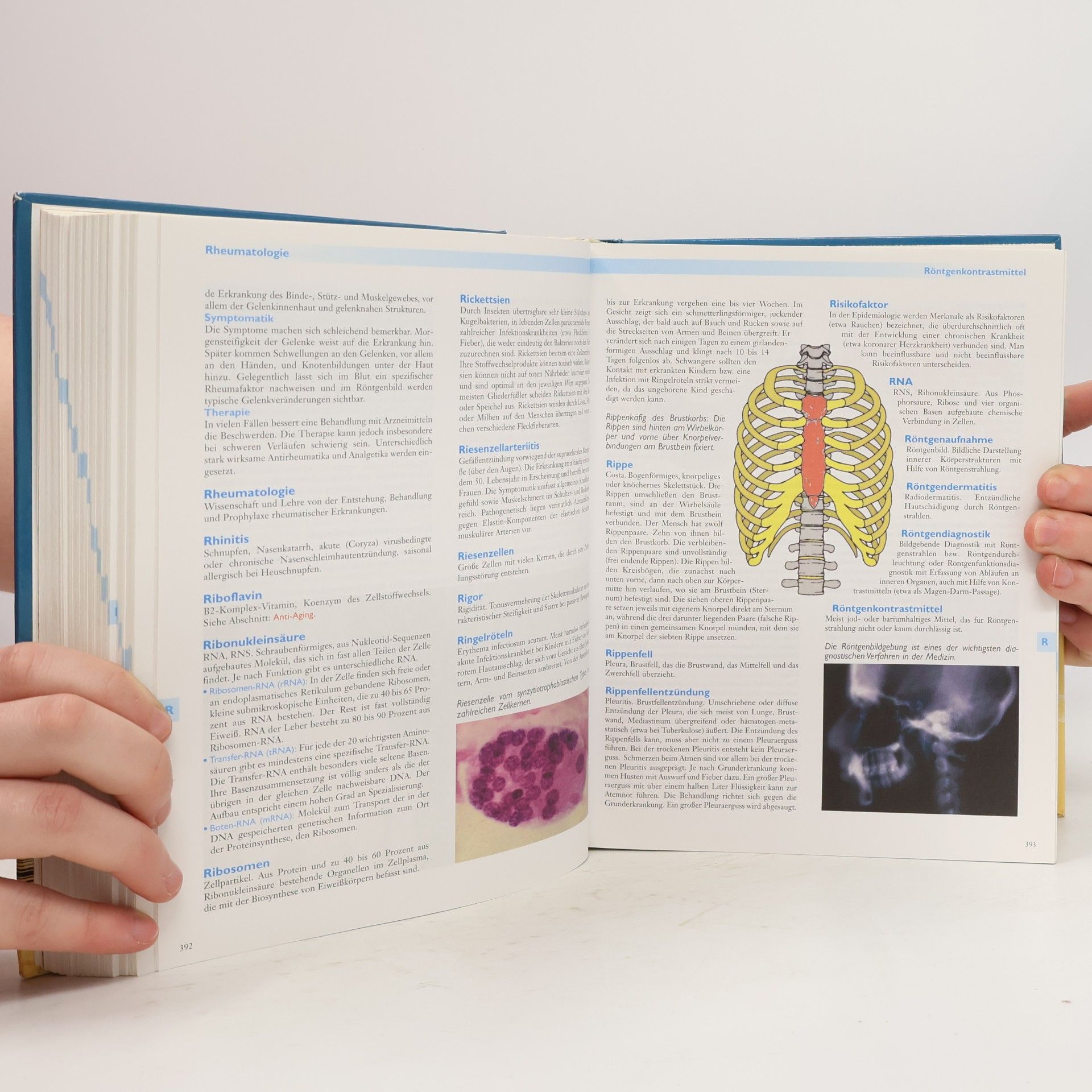 Eberhard J. Wormer Neues großes Lexikon Medizin & Gesundheit