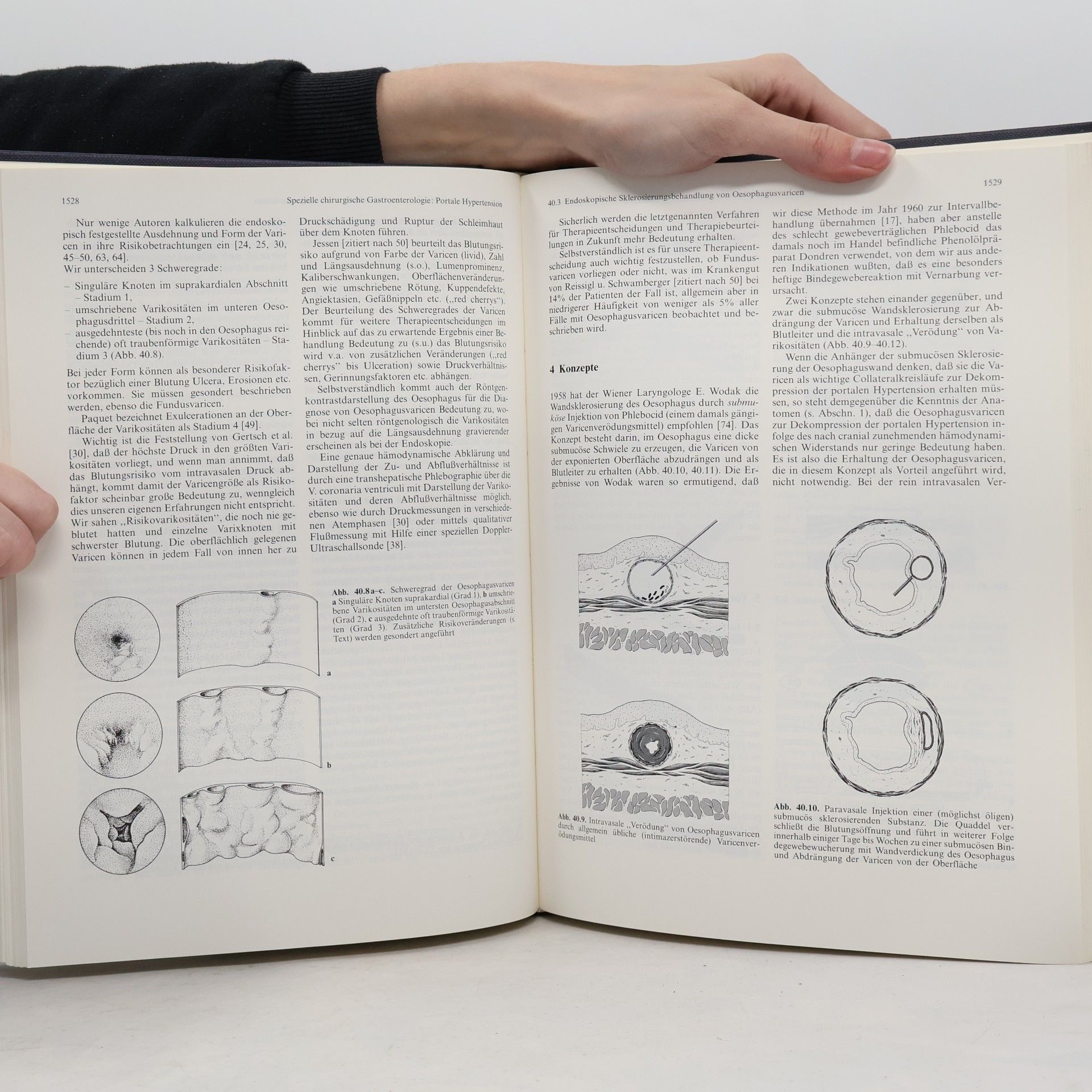 Jörg R. Siewert Chirurgische Gastroenterologie 3