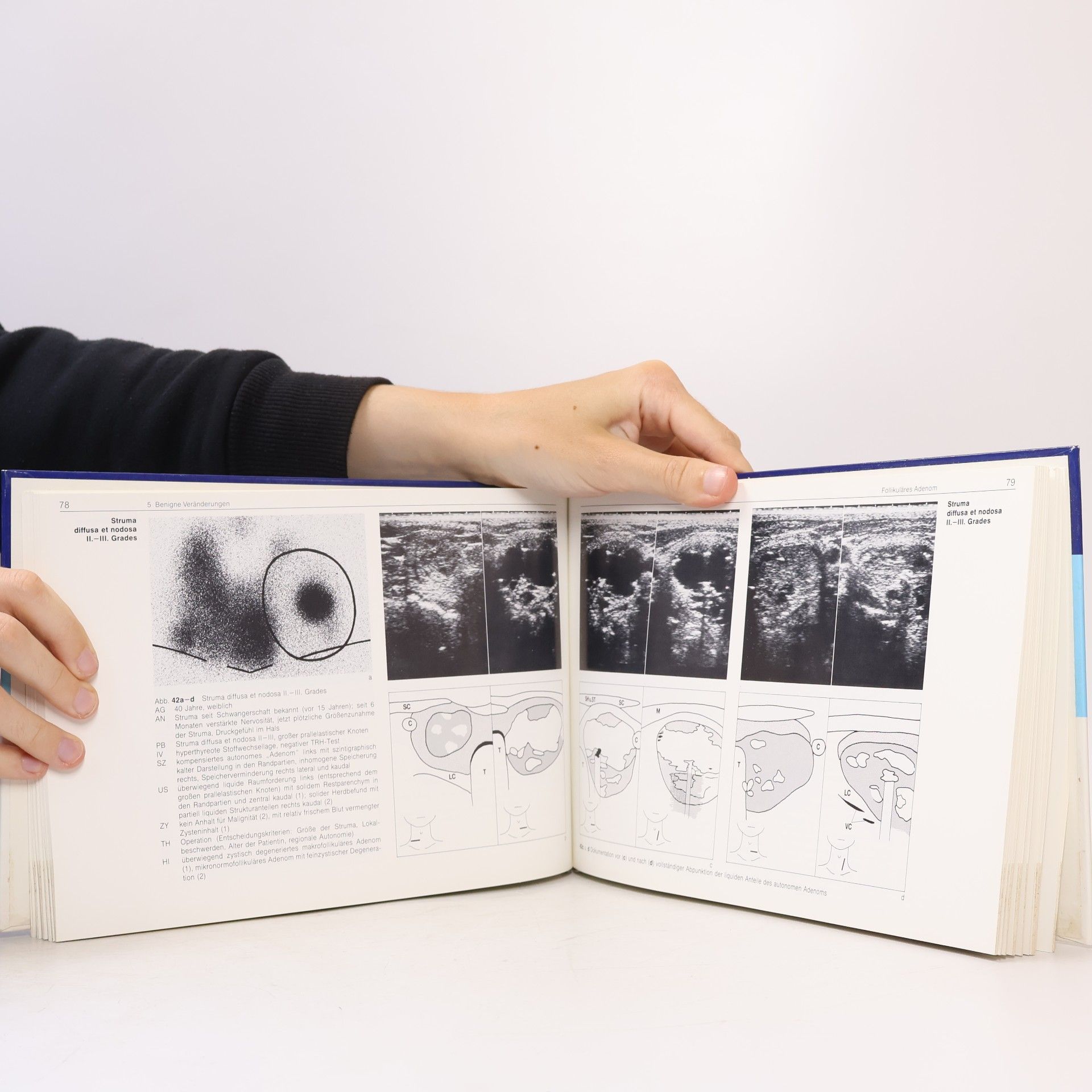 Walter Wiedemann Sonographie und Szintigraphie der Schilddrüse