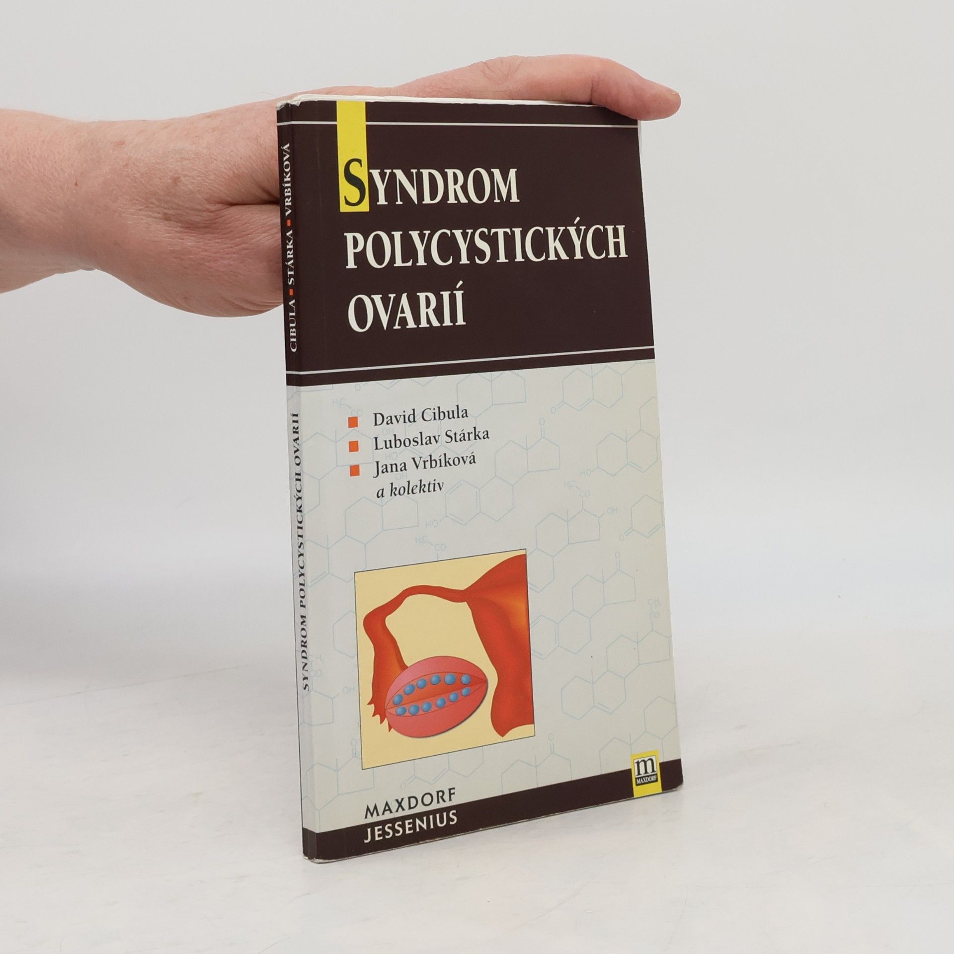Syndrom polycystických ovarií