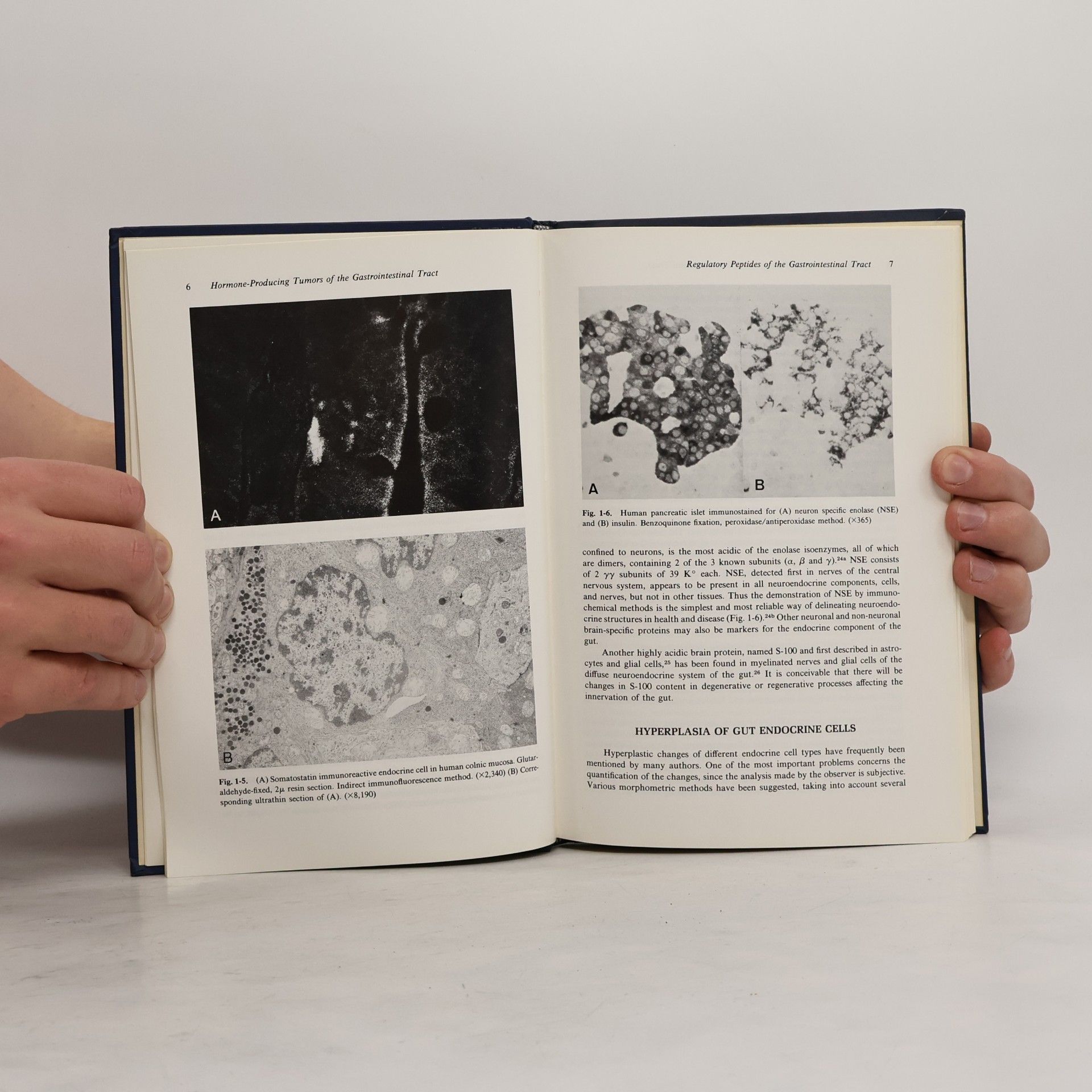Jack S. Cohen Contemporary Issues in Gastroenterology - 5: Hormone Producing Tumors of the Gastrointestinal Tract