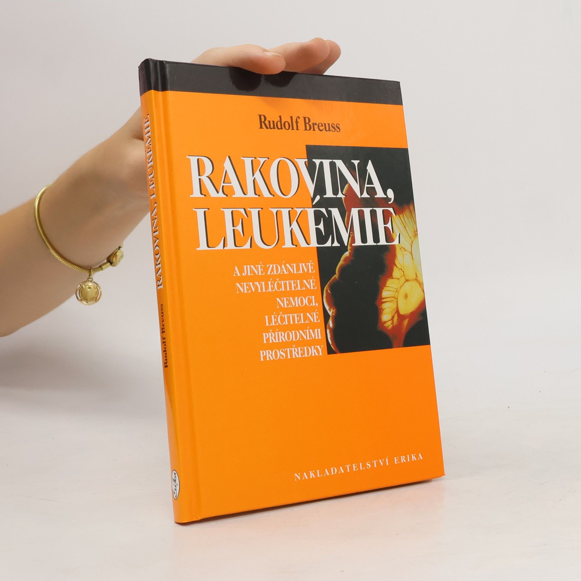 Rudolf Breuss Rakovina, leukémie a jiné zdánlivě nevyléčitelné nemoci, léčitelné přírodními prostředky