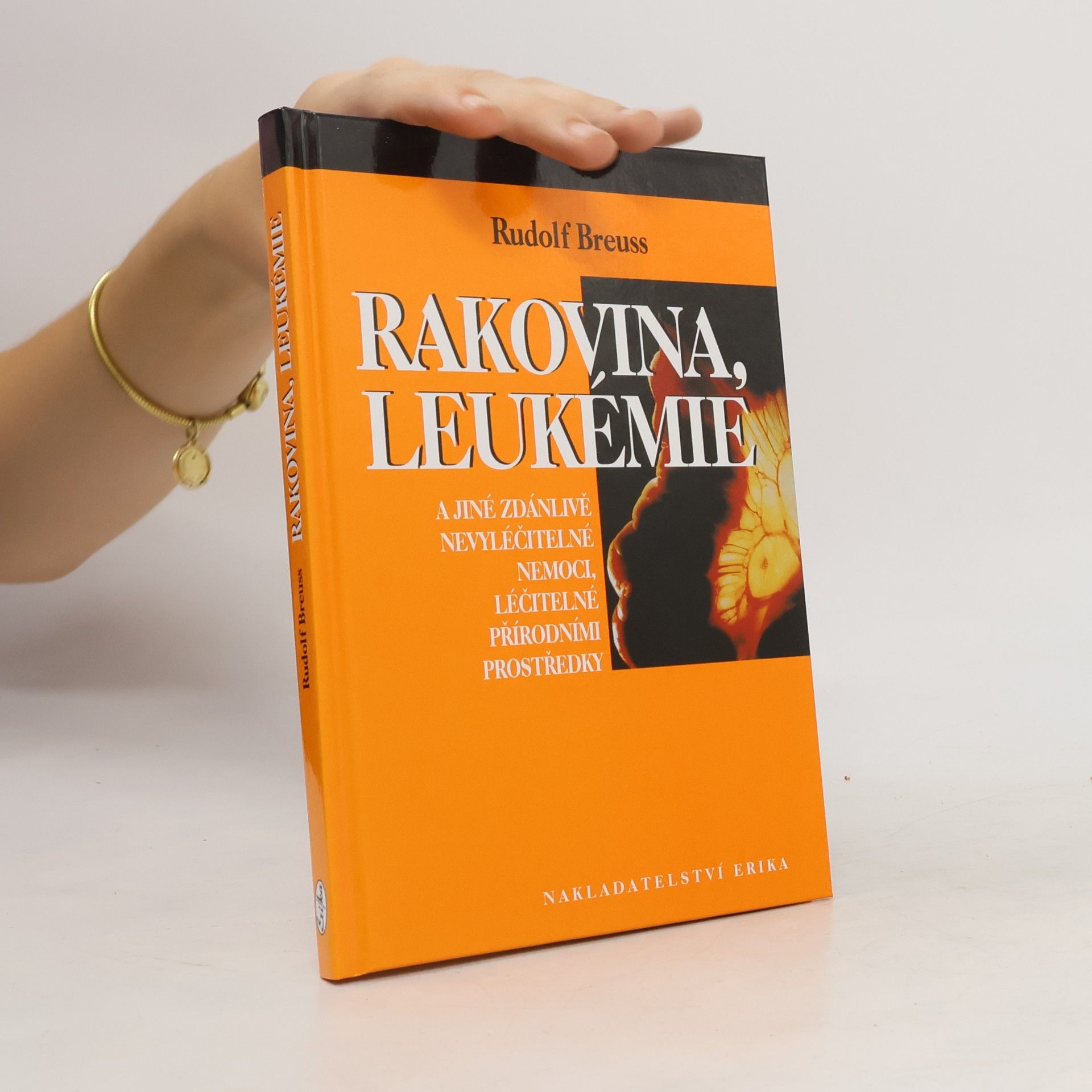 Rudolf Breuss Rakovina, leukémie a jiné zdánlivě nevyléčitelné nemoci, léčitelné přírodními prostředky
