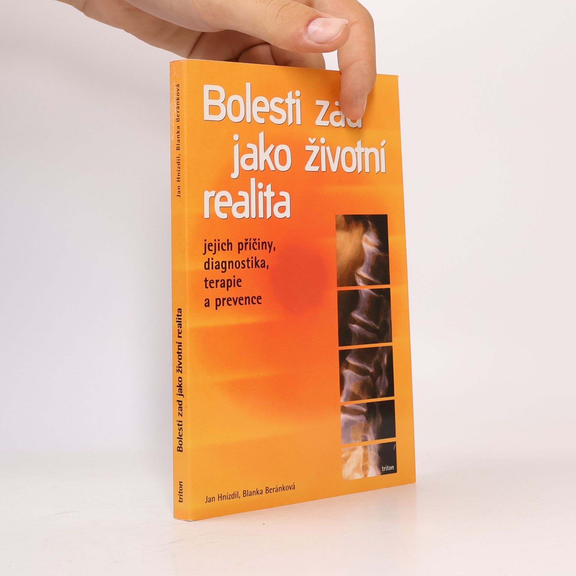 Bolesti zad jako životní realita. Jejich příčiny, diagnostika, terapie a prevence
