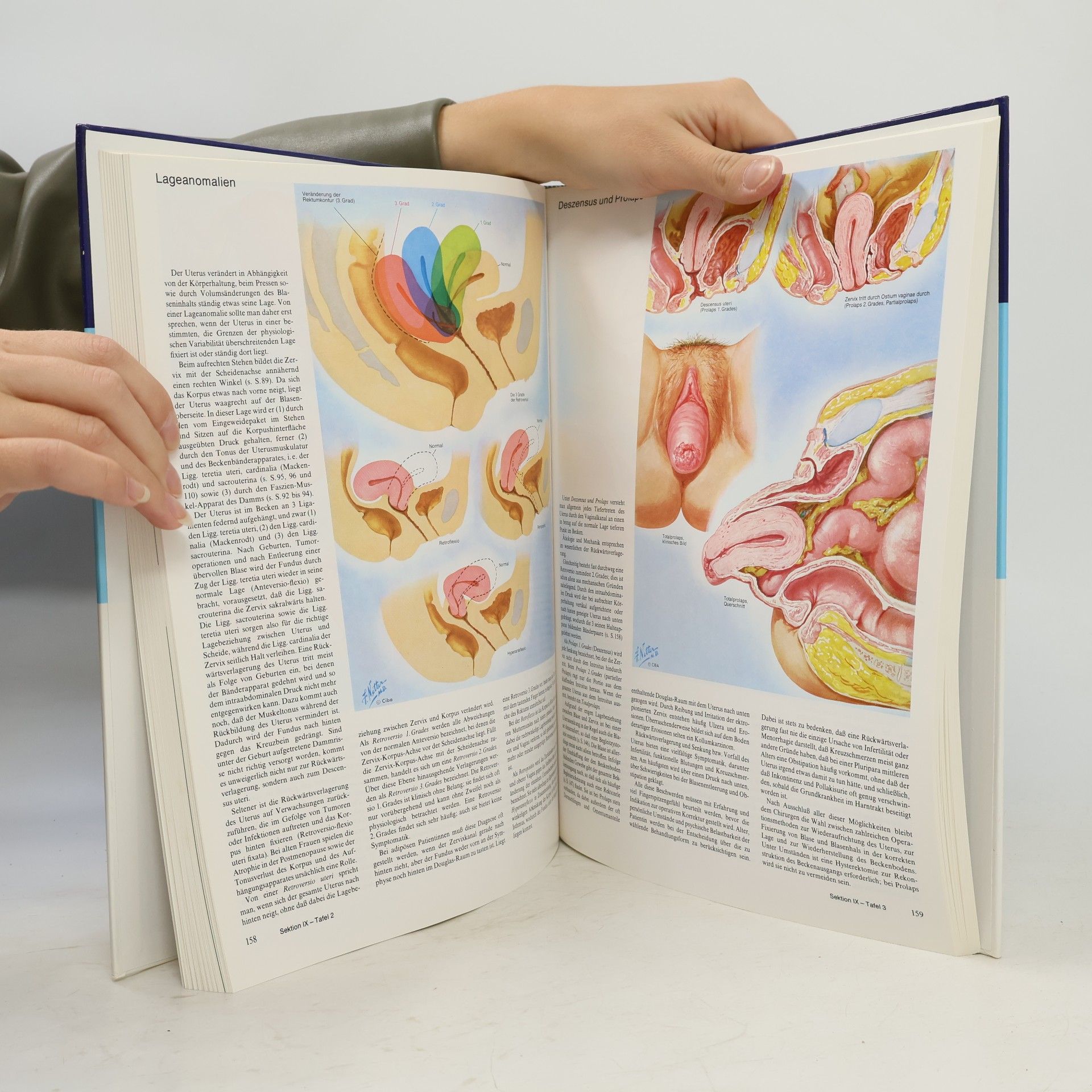 Autorenkollektiv Farbatlanted der Medizin. Band 3: Genitalorgane. 2. Aufl.